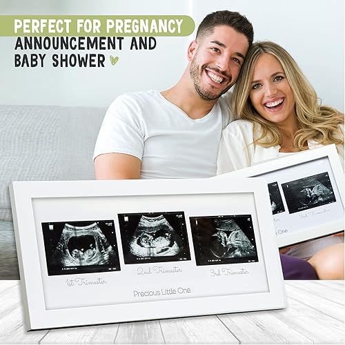 Miniatura 4 de KeaBabies Marco de fotos de triple ecograma para bebé y diario de embarazo, paquete de anuncios de embarazo, decoración de guardería para bebé,