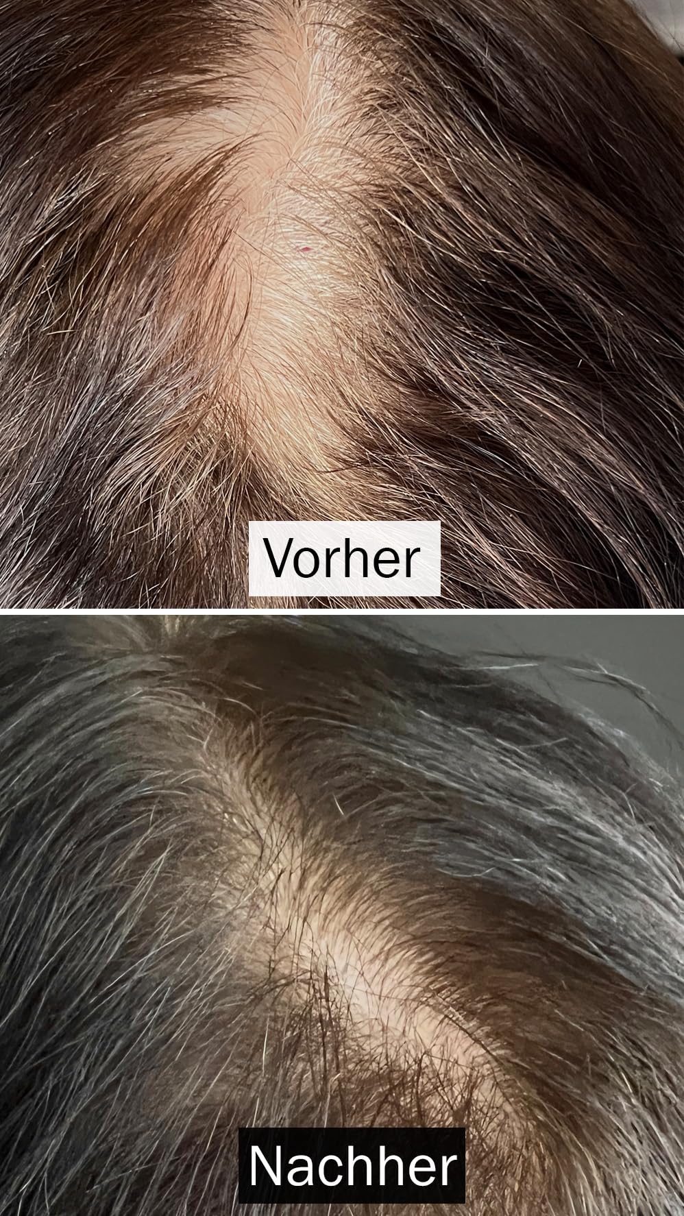 Haarserum für Fülle & Wachstum - Vegan & 100% natürlich, Klinisch Erprobter Wirkstoff mit Koffein, 50 ml - Stimuliert Haarwachstum, Reduziert Haarausfall, Dermatologisch Getestet