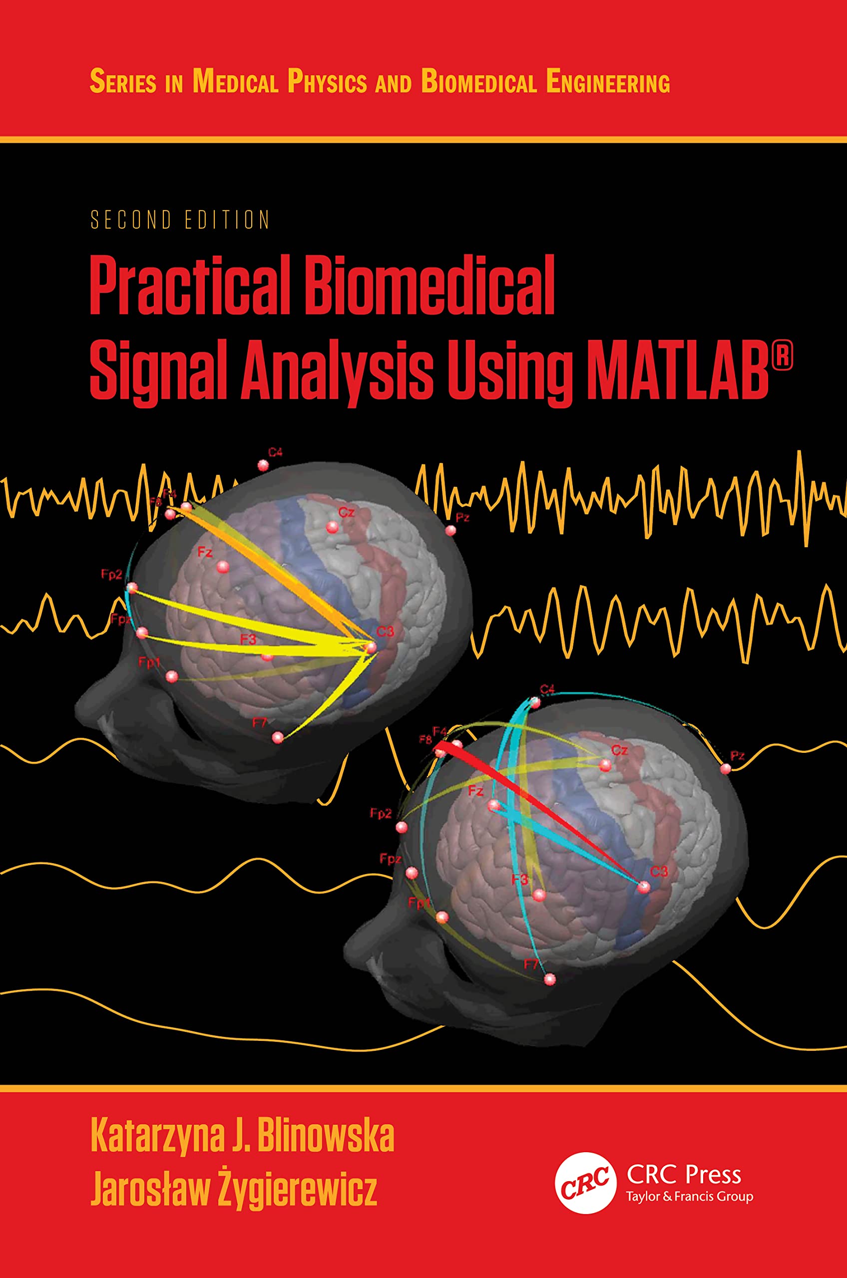 Practical Biomedical Signal Analysis Using MATLAB(r) (Series in Medical Physics and Biomedical Engineering)