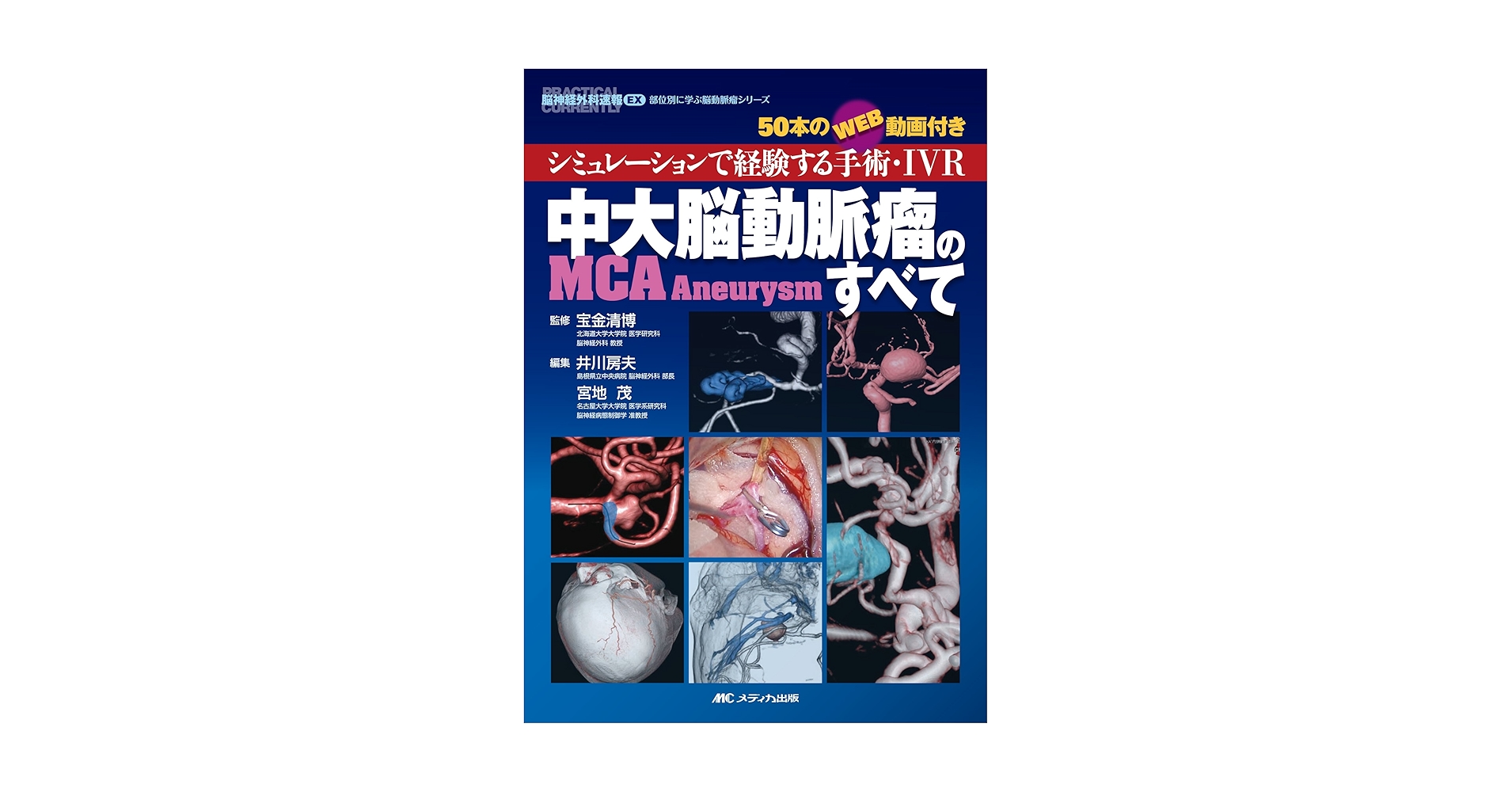 内頚動脈瘤(ICA Aneurysm)のすべて-遠位部(supraclinoid): シミュレーションで経験する手術・IVR/50本のWEB動画付き (脳神経外科速報EX部位別に学ぶ脳動脈瘤シリーズ) 前大脳動脈瘤・椎骨脳底動脈瘤(ACA・VBA Aneurysm)のすべて