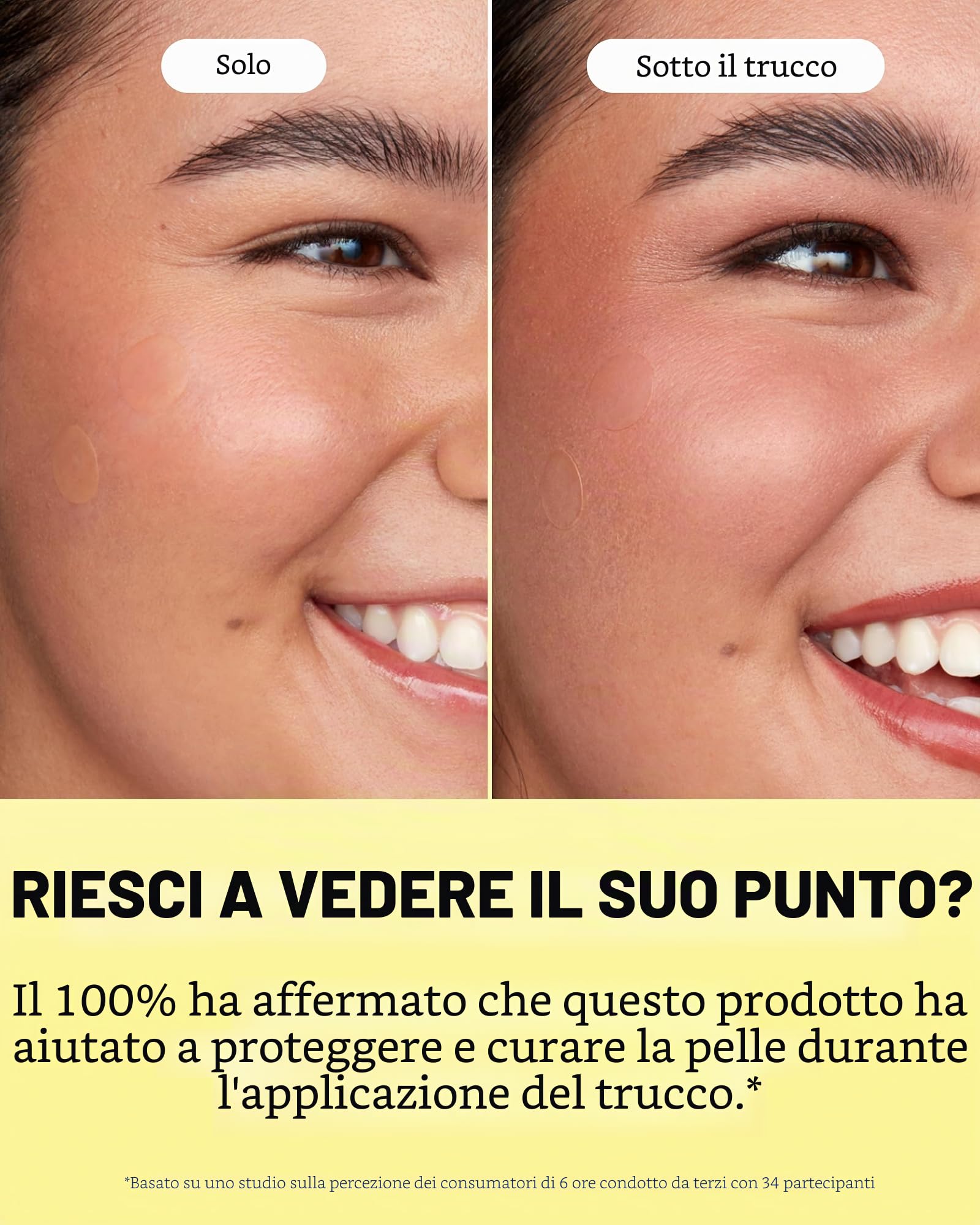 Peace Out Skincare Acne Day Dot Jumbo, cerotti idrocolloidali velati ad azione rapida con acido salicilico, ultra sottili, praticamente invisibili, eliminano rapidamente scoppi, imperfezioni e brufoli