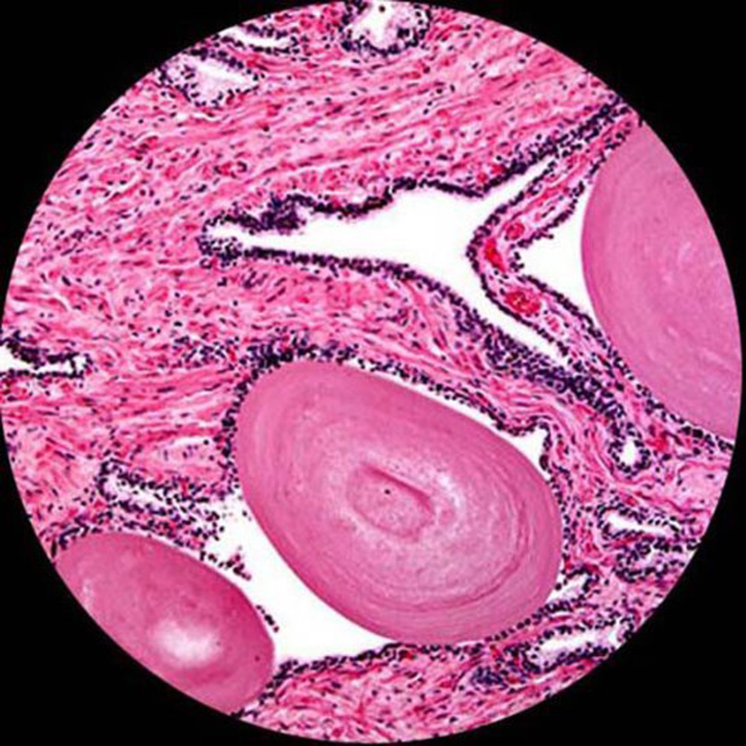C-mara de 5.0 megap-xeles AmScope MA500 Microscopio digital compatible de Windows y Mac OS
