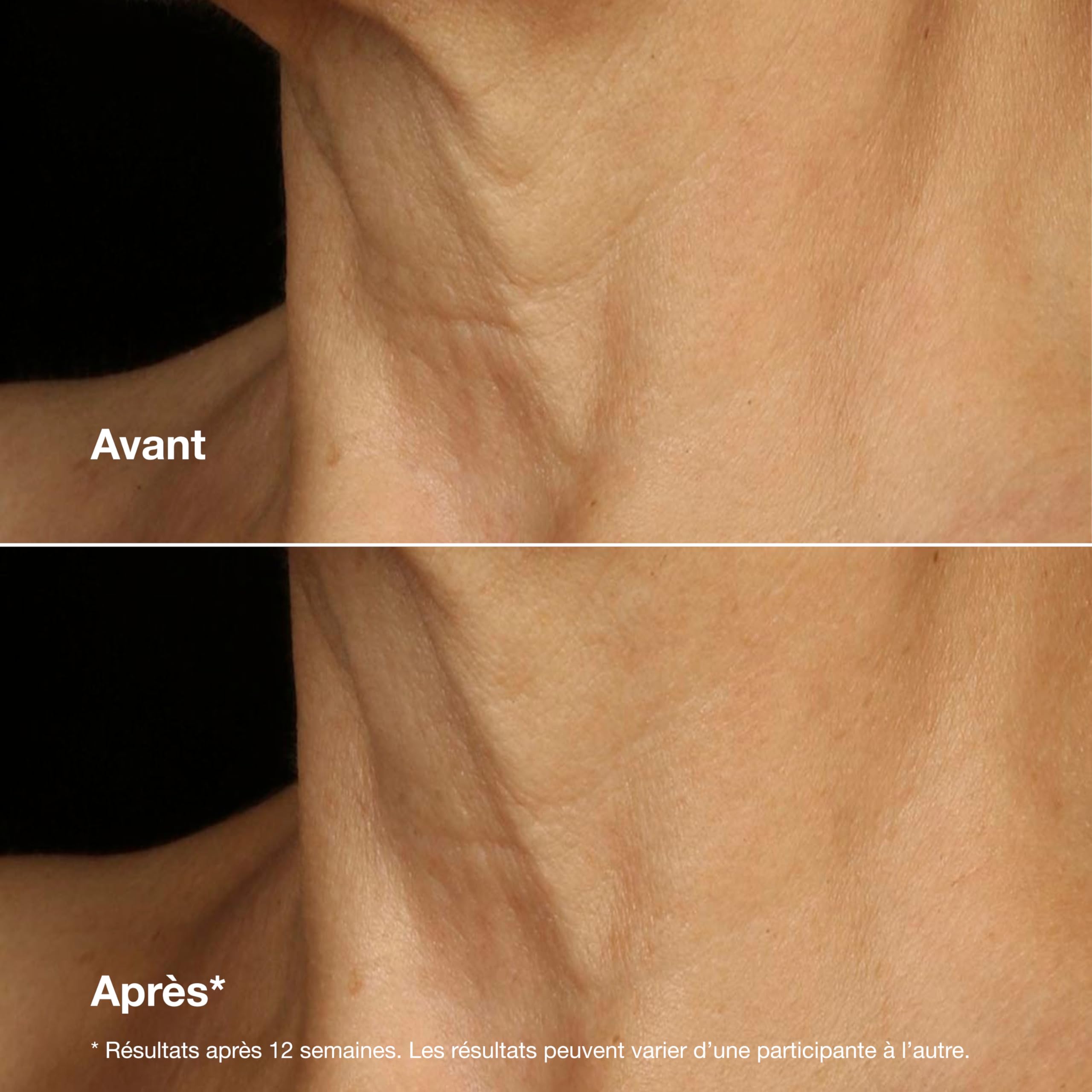 Clinique Smart Clinical Repair Crème Liftante Visage + Cou aux Peptides 9% + Acide Hyaluronique | Anti-Âge + Hydratant