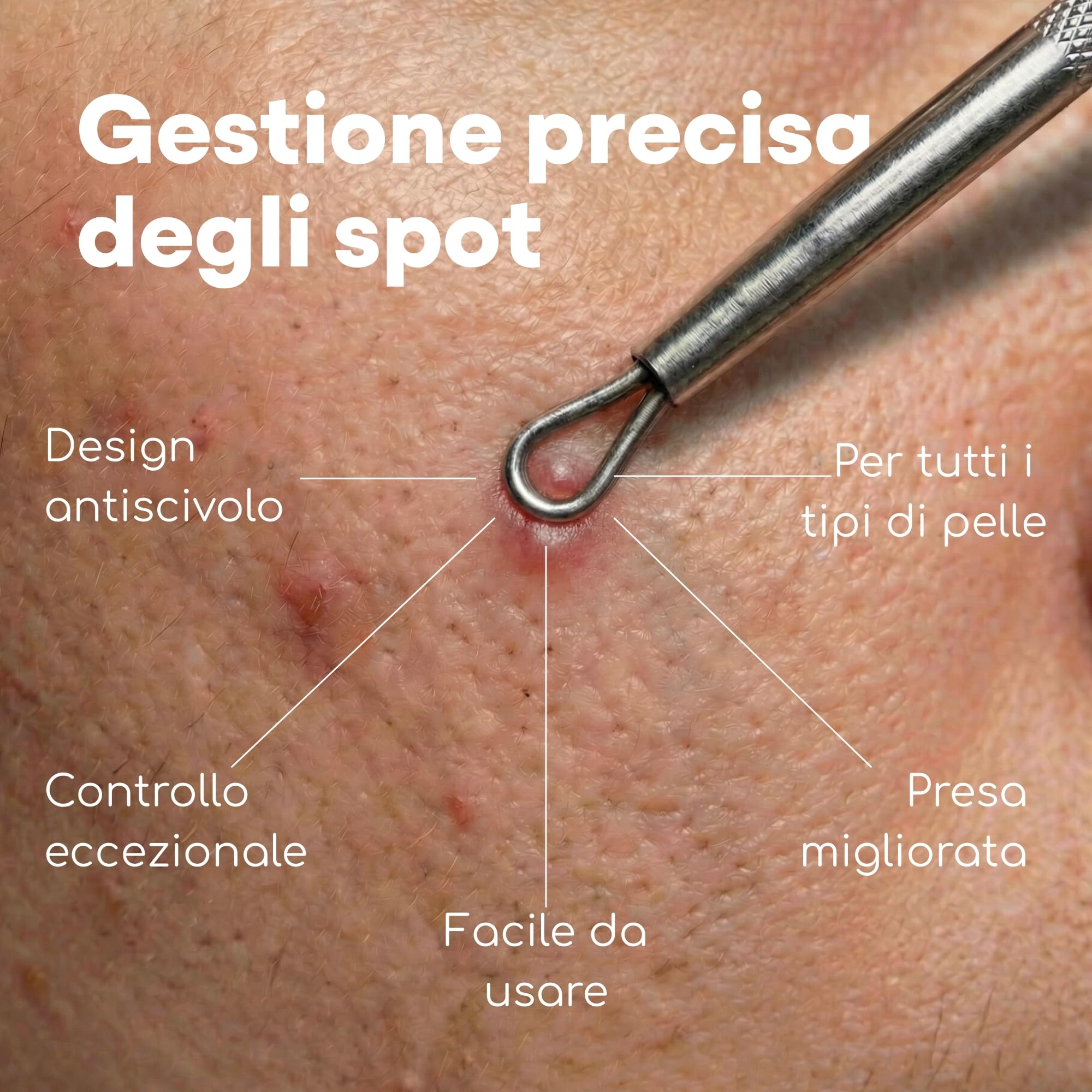 Medi Grade Kit Schiaccia Brufoli e Estrattore Punti Neri Medi Grade, Set di 7 Strumenti Togli Punti Neri