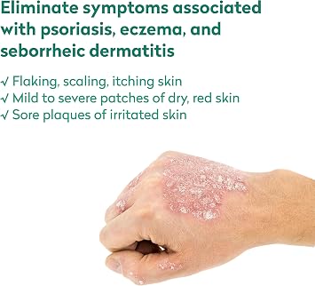 Dr. Blaines REVITADERM Psoriasis Formula - Soothing Topical Cream with Coal Tar, Tea Tree Oil and Lavender Oil for Itching, Flaking, Dry, Cracked Skin Relief - 4 fl. oz. - Includes Travel Size Bottle