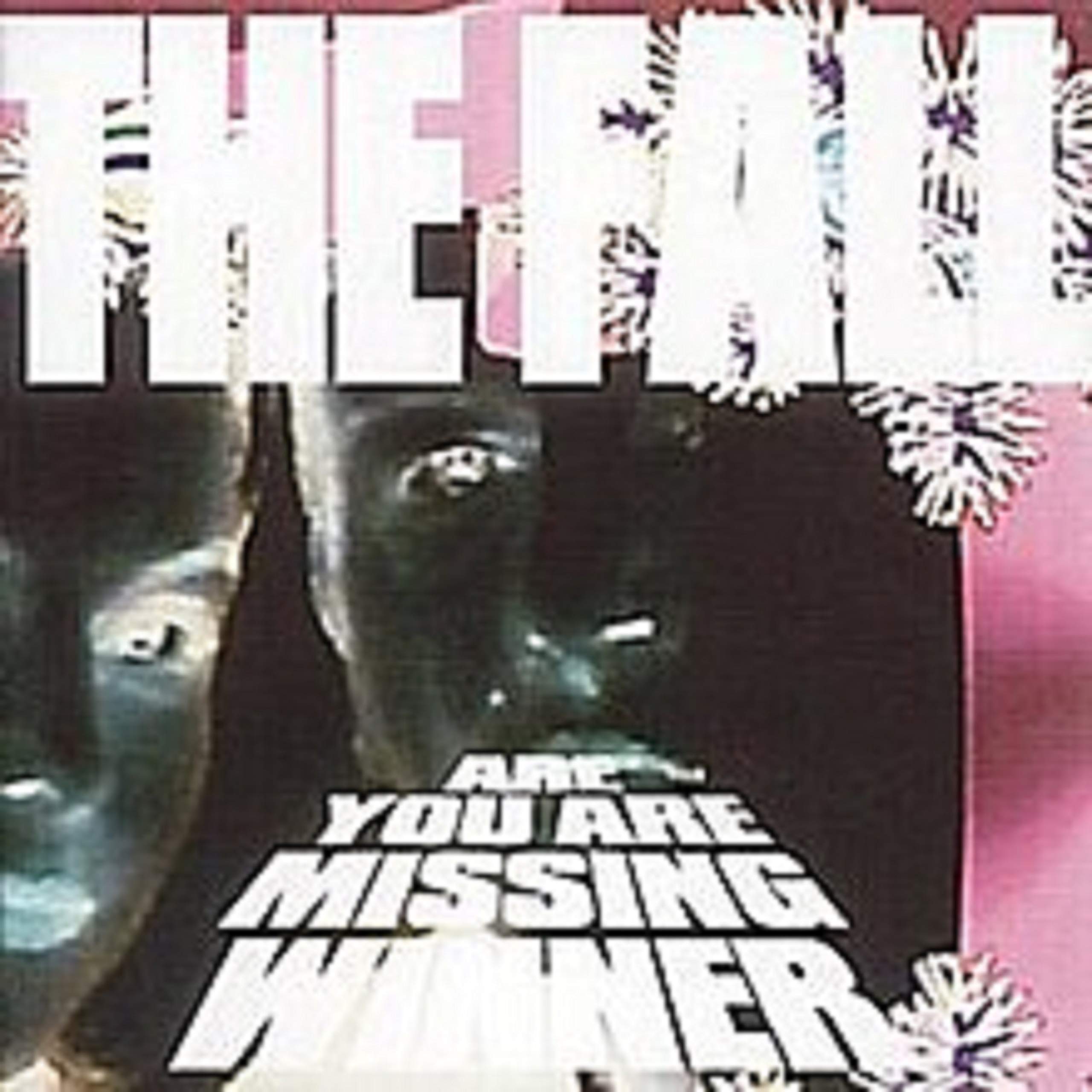 Are You Are Missing Winner (4CD)