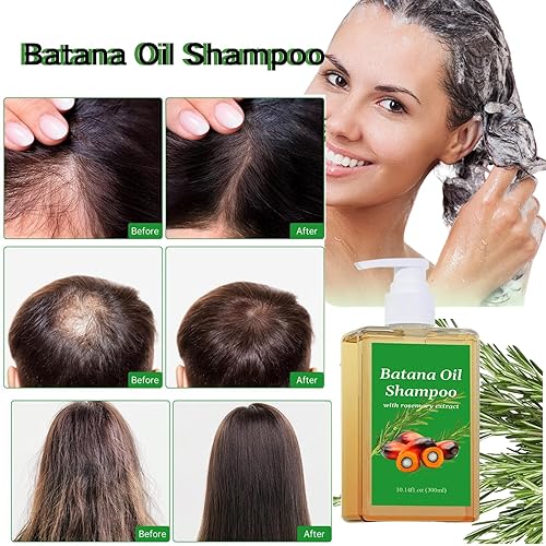 Miniatura 3 de Champú de aceite de Batana, Champú Batana, Champú de aceite de romero, champú de batana, champú de batana con extracto de romero