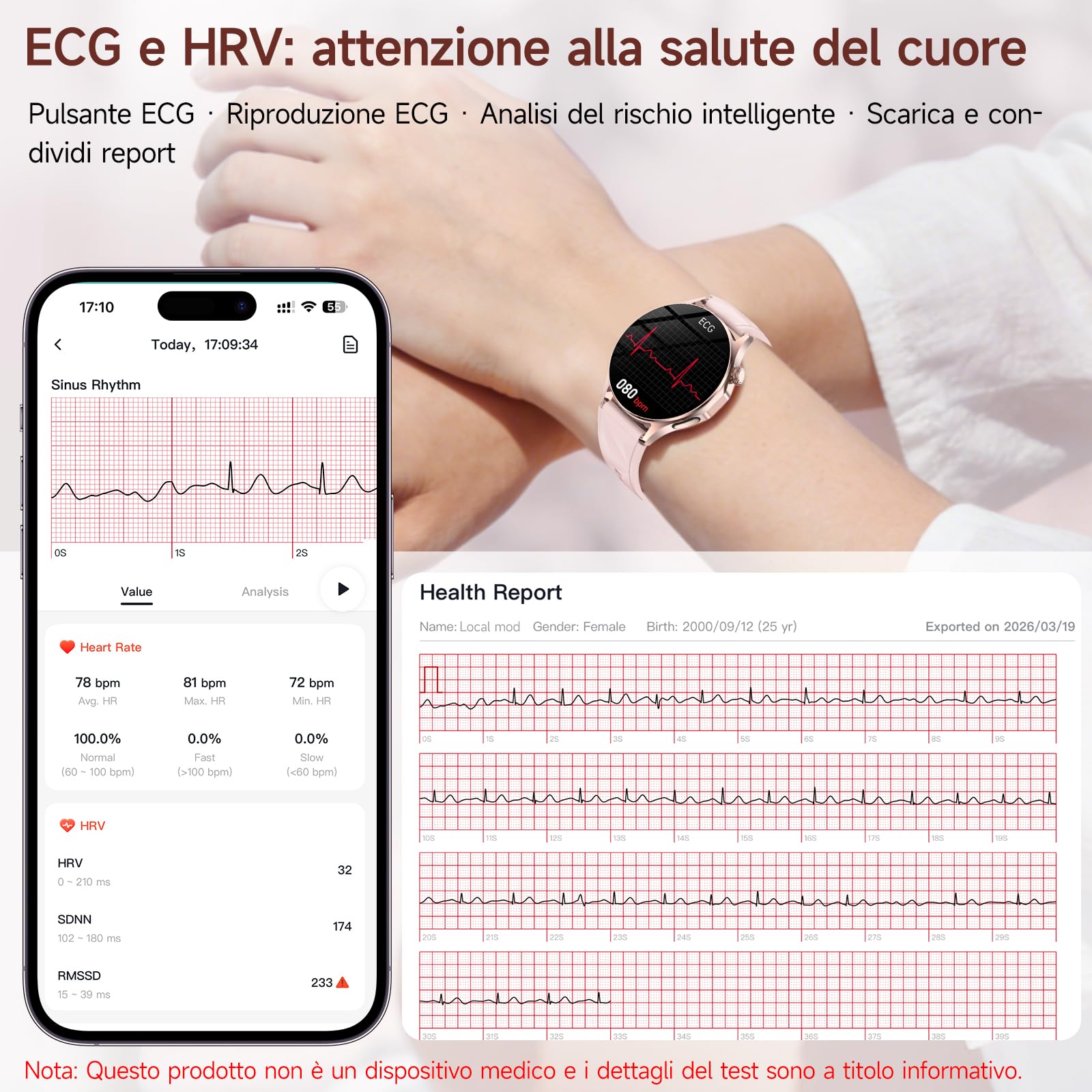 2026 Nuovo Smartwatch Donna con ECG/HRV/Acido Urico/Lipidi,1.32" AMOLED Orologio con 24H Chiamate, Pressione Sanguigna, Salute femminile, Cardiofrequenzimetro, Sonno, SOS, Fitness Watch Android e iOS