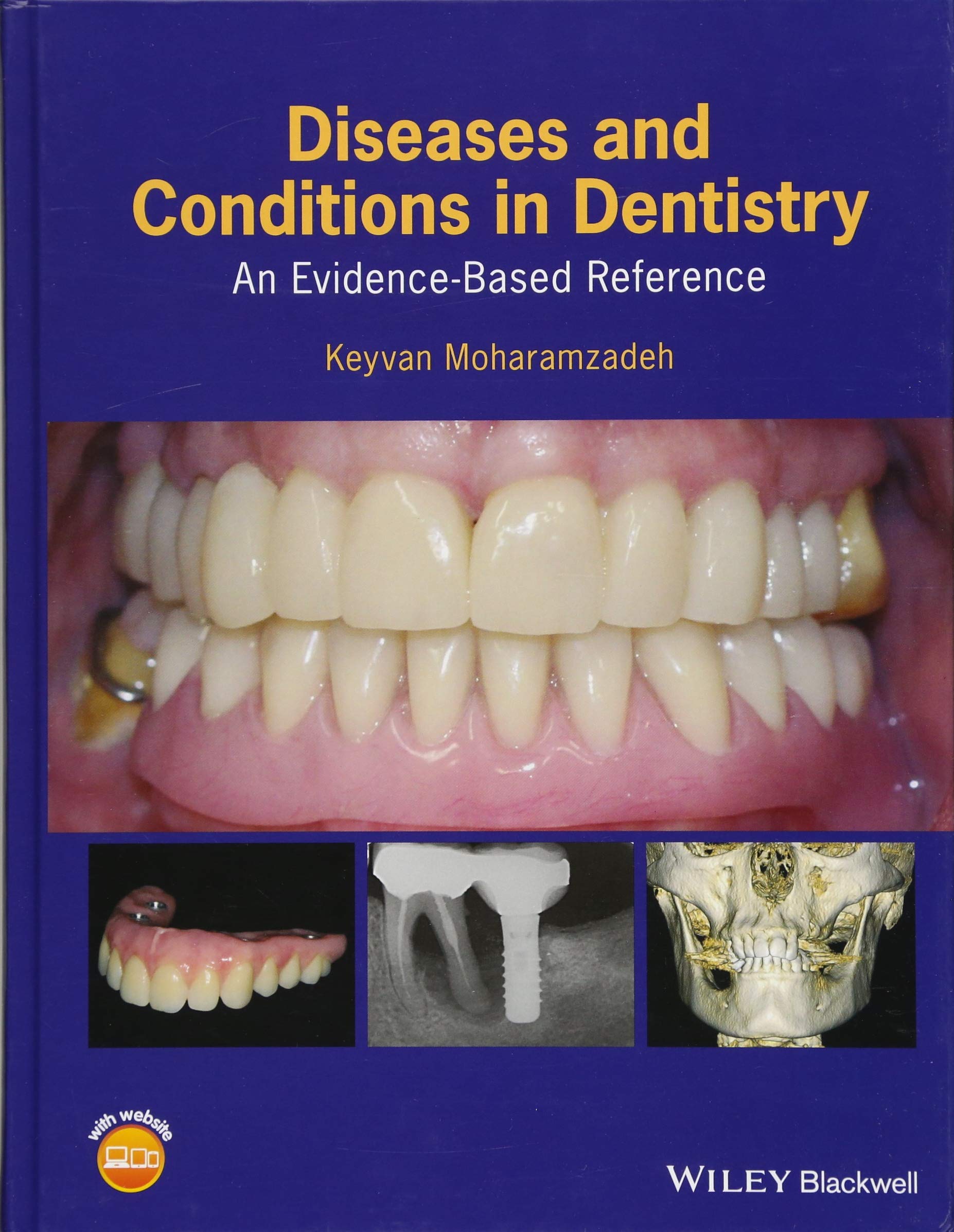 Wiley-Blackwell Diseases and Conditions in Dentistry: An Evidence–Based Reference