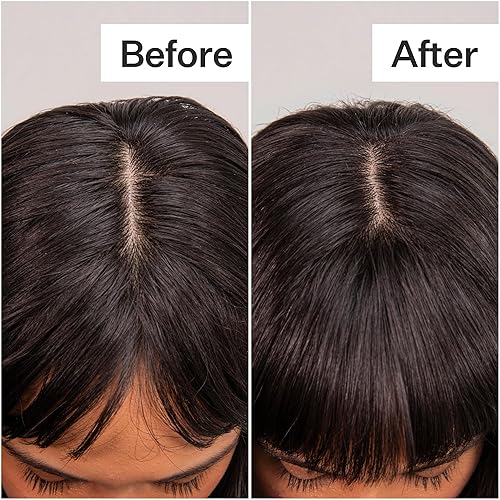 Miniatura 6 de ActAcre - Champú seco a base de plantas - Champú en aerosol natural y sin perfume con ácido fúlvico y arroz que refresca el cabello graso y restaura