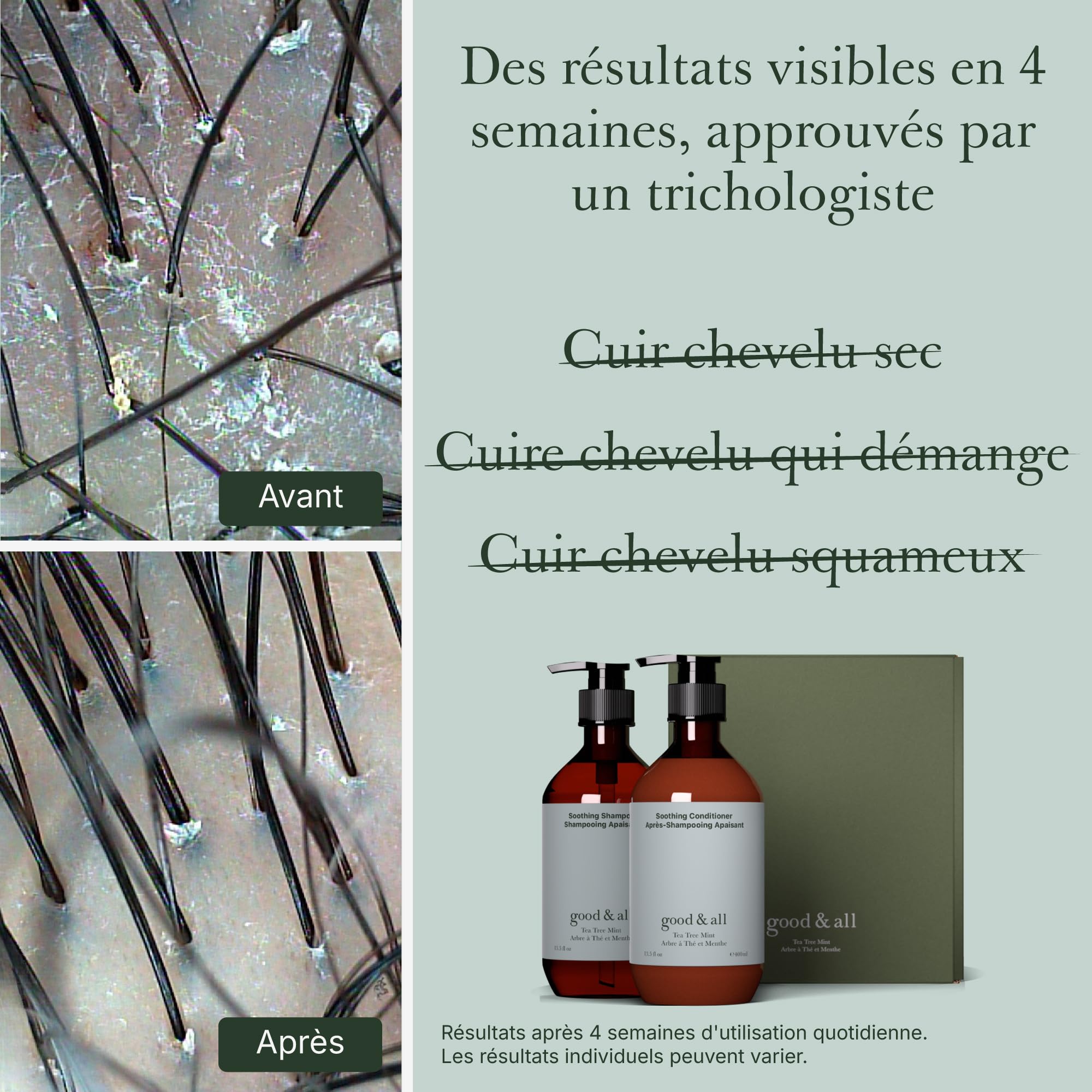 Good&All Shampooing et Après-Shampooing Anti-Démangeaisons, Cuirs Chevelus Irrité, Sec & Sensibles - Arbre à Thé, Menthe Poivrée - Sans Sulfate, Silicone, Paraben, Parfum - 400ml