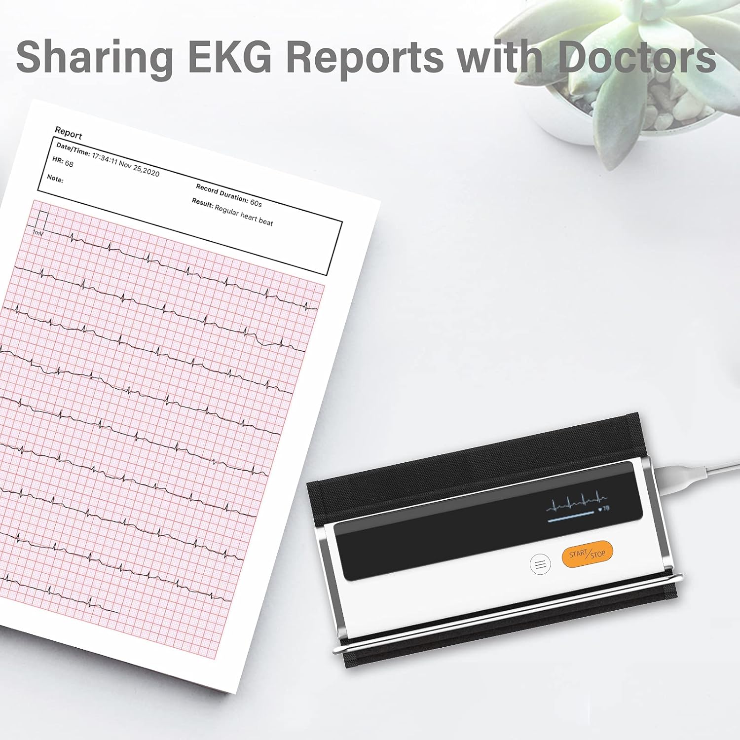 A printed report showing ECG data and a smartphone displaying the ViHealth app, illustrating the ability to share EKG reports with doctors.