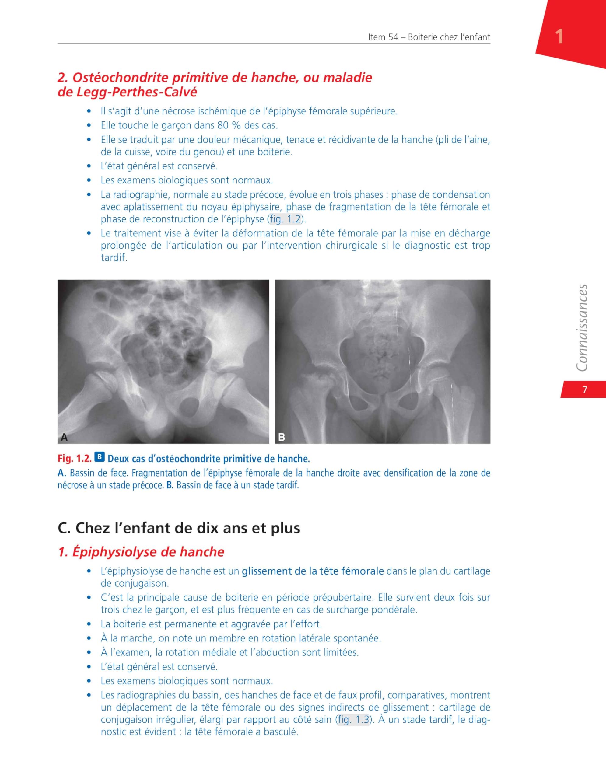 Rhumatologie: Réussir ses EDN