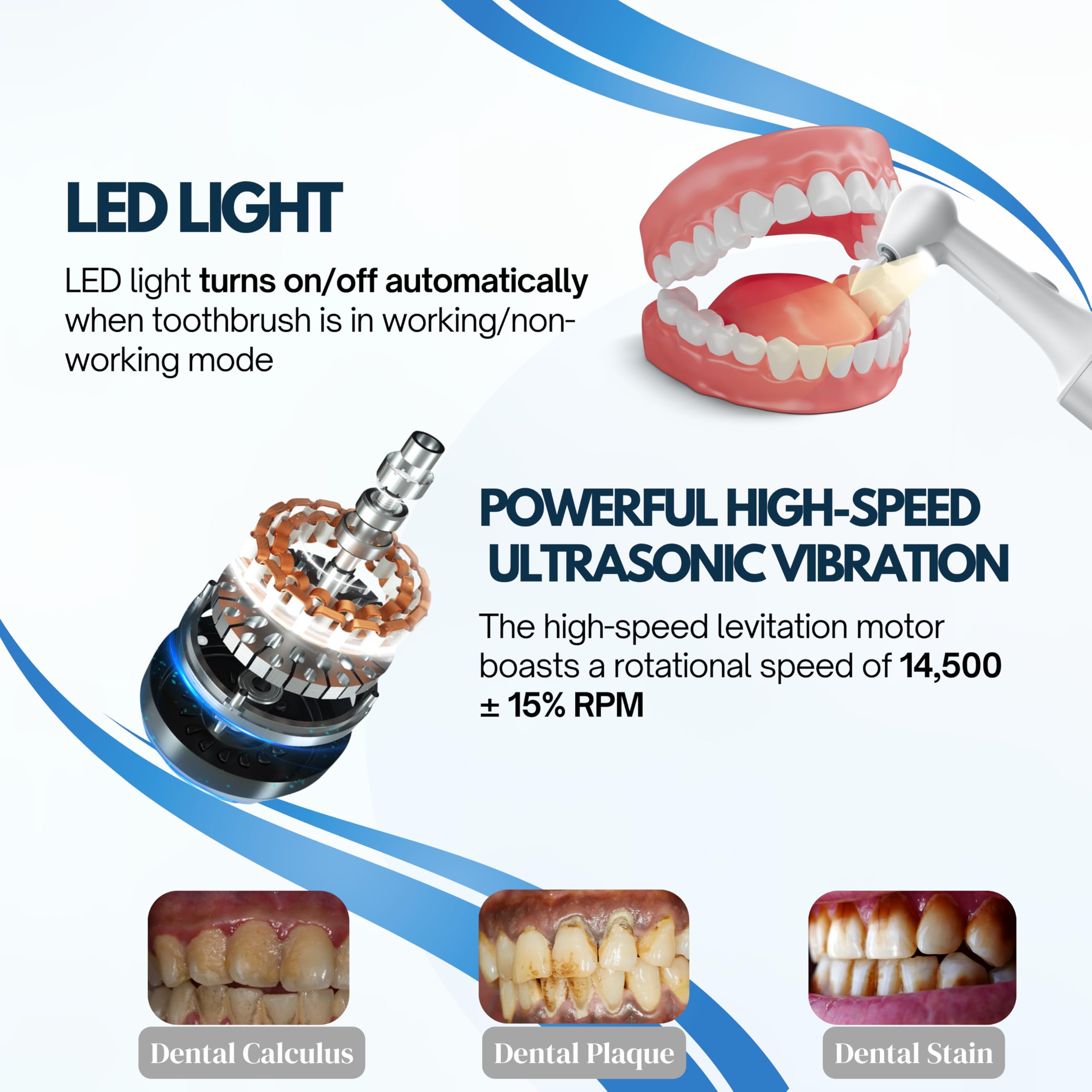 Polisseuse à dents électrique à ultrasons – Détachant de calcul dentaire et de plaque dentaire rechargeable avec 5 têtes, 3 modes et lumière LED pour soins dentaires à domicile