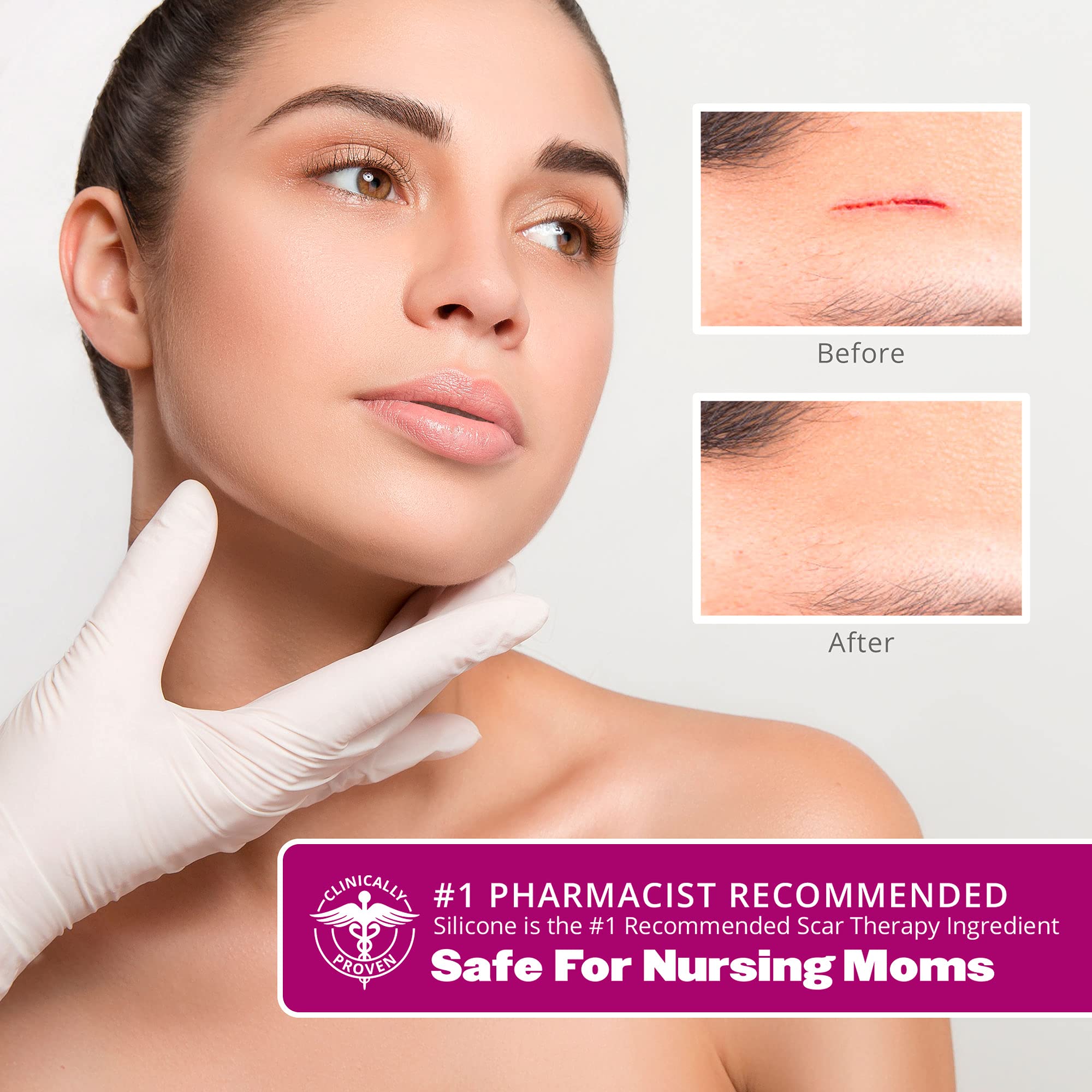 MedicalGrade Scar removal sheet, Clinically Proven, Silicone sheets