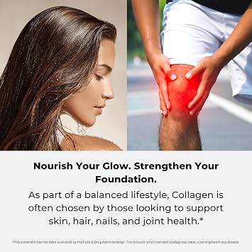 Paradise Herbs Collagen Extreme with Biocell Collagen, Hyaluronic Acid, and Nature's C, for Healthy Hair, Skin, and Joints, 60 Capsules