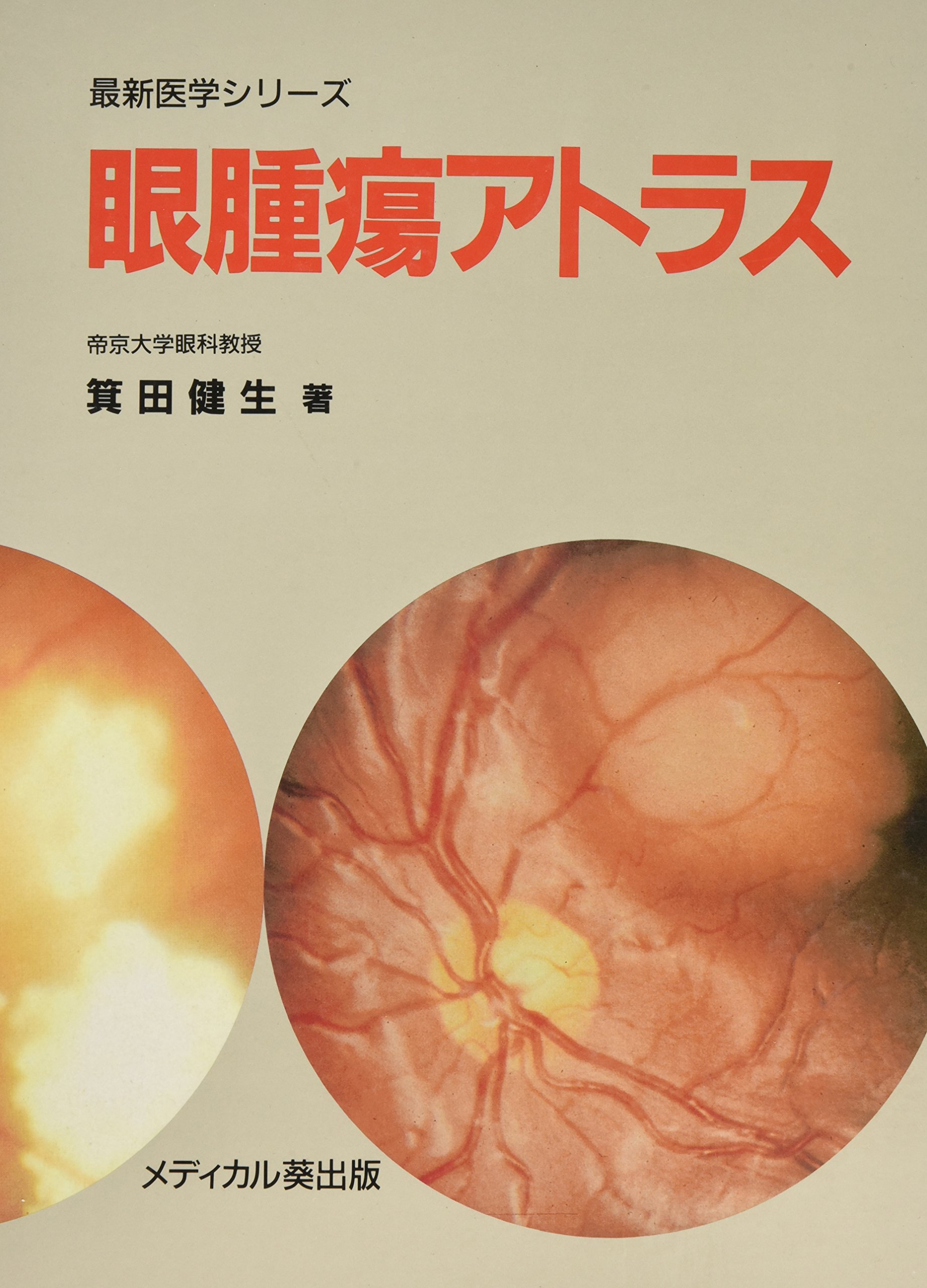 激安通販新作 眼内腫瘍アトラス 新品 asakusa.sub.jp