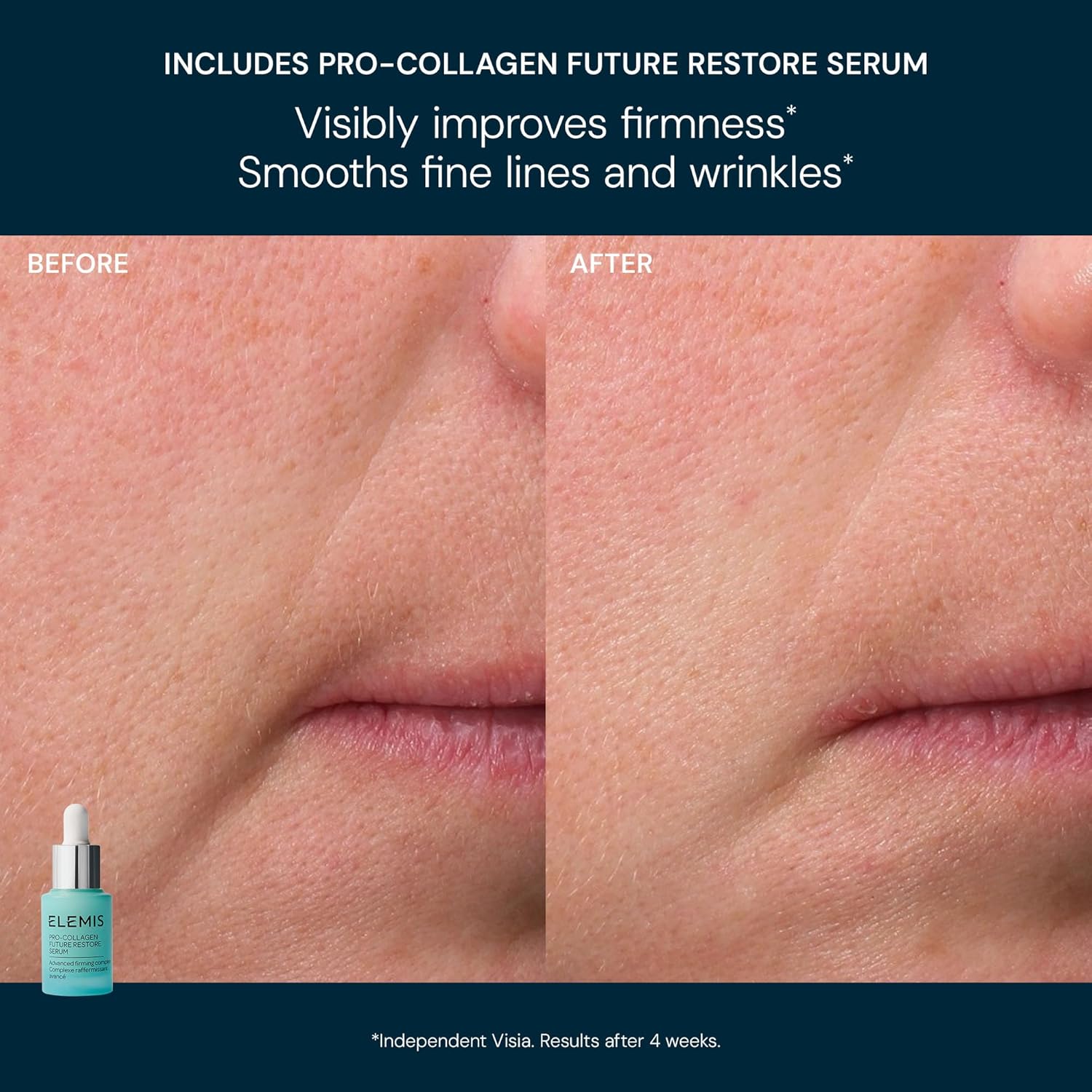 ELEMIS x Aston Martin Formula One™ Team Iconic Discovery Skincare Collection ($175 Value) - Travel Essentials - Image 3