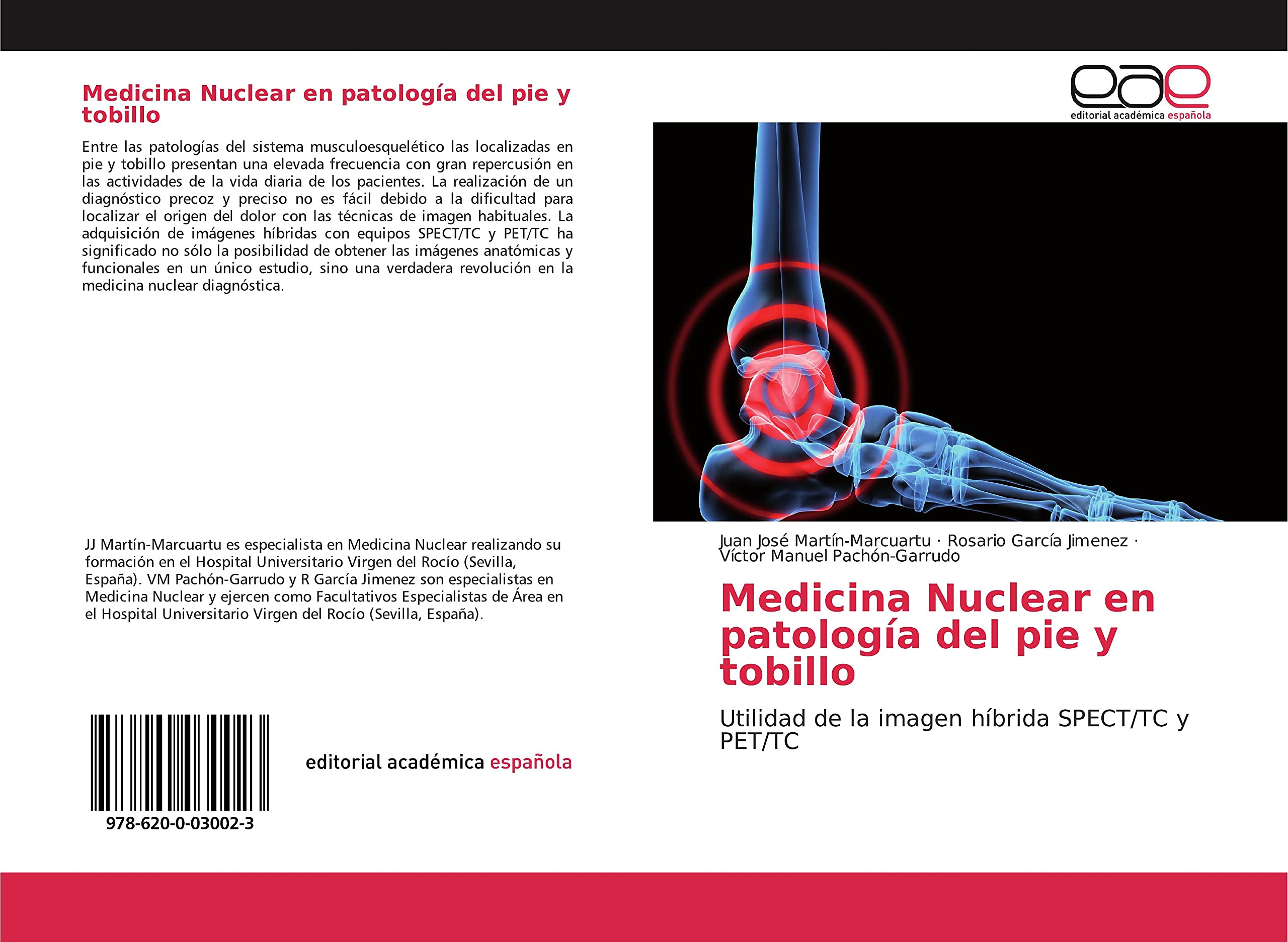 Medicina Nuclear en patología del pie y tobillo: Utilidad de la imagen híbrida SPECT/TC y PET/TC (Spanish Edition)