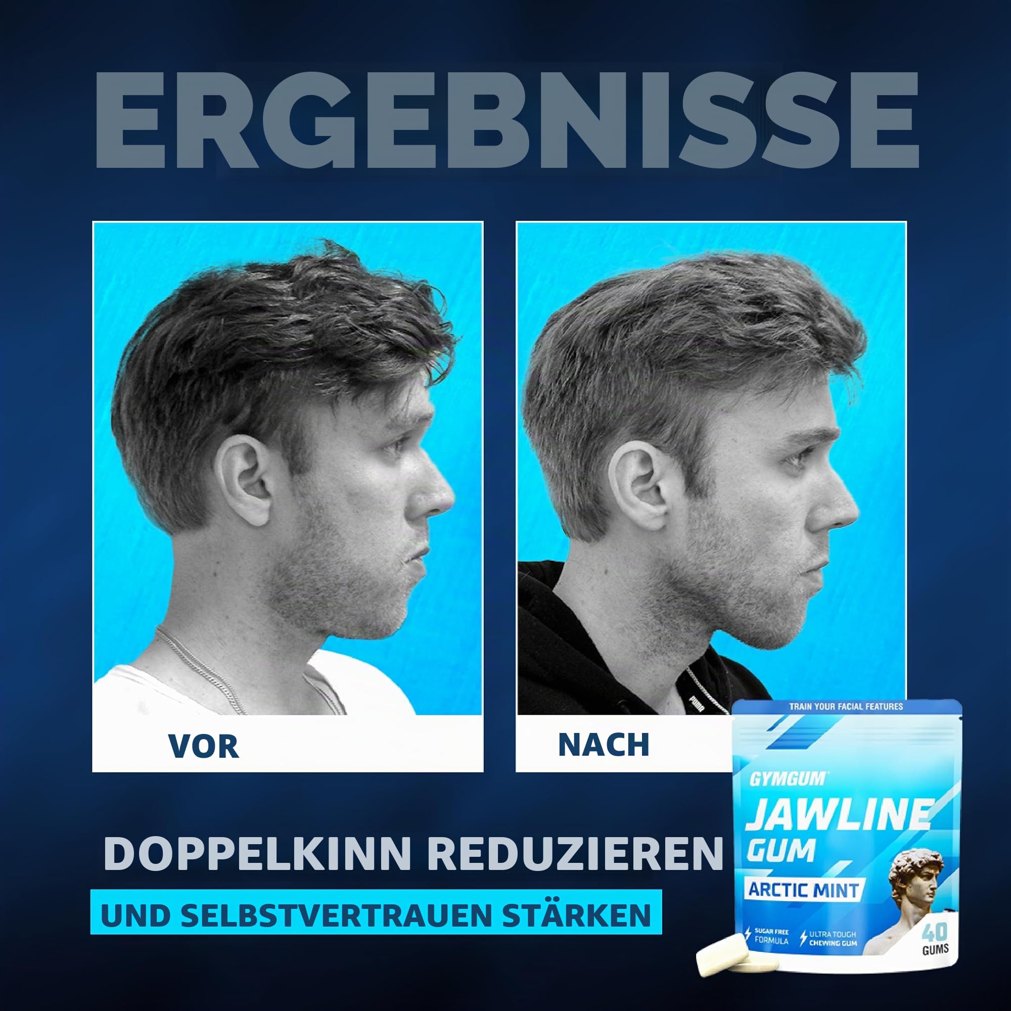 GYMGUM Kiefergummi | Hartes Kaugummi für Kieferstärke | Trainieren Sie Ihre Gesichtszüge – Mewing Kiefergummi | Ultimativer Kiefertrainer | 0 Kalorien & zuckerfreies Hartgummi (120 Stück, Arctic Mint)