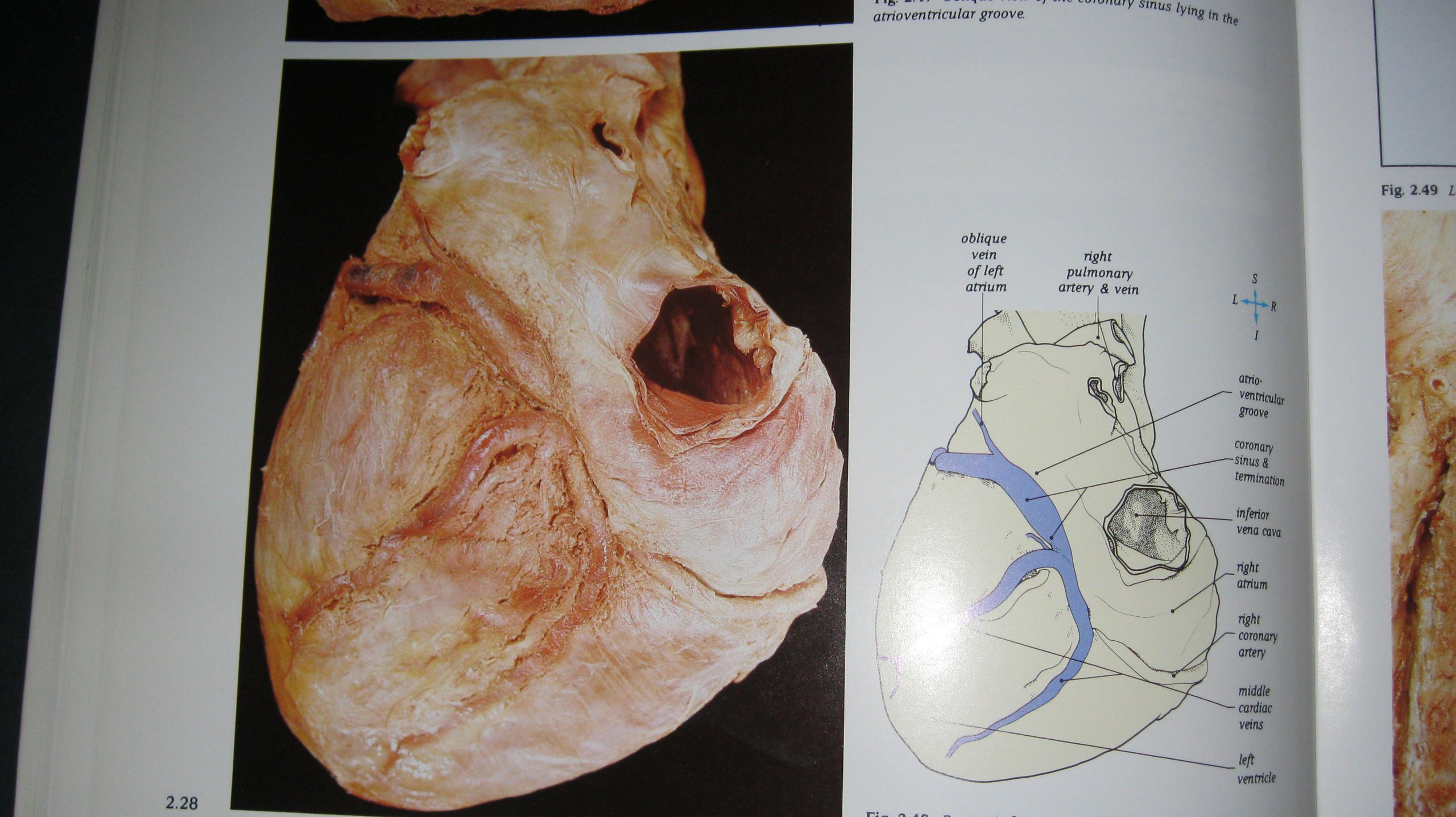 Atlas Human Anatomy & Integ Text