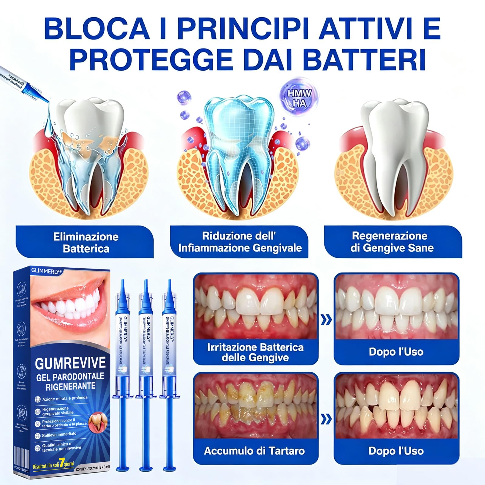 Glimmerly Gumrevive Gel Parodontale Rigenerante - 3 X 3 Ml/4Confezione | Sbiancamento Dentale Profondo, Gel Lenitivo Naturale Per La Protezione Delle Gengive, Sollievo Rapido, Alito Fresco