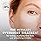 skyn ICELAND Dissolving Microneedle Under Eye Patches with 39% Hyaluronic Acid and Peptides, No Slip Overnight Eye Mask for Fine Lines, Wrinkles and Firming, Vegan, All Skin Types, 5 Pairs
