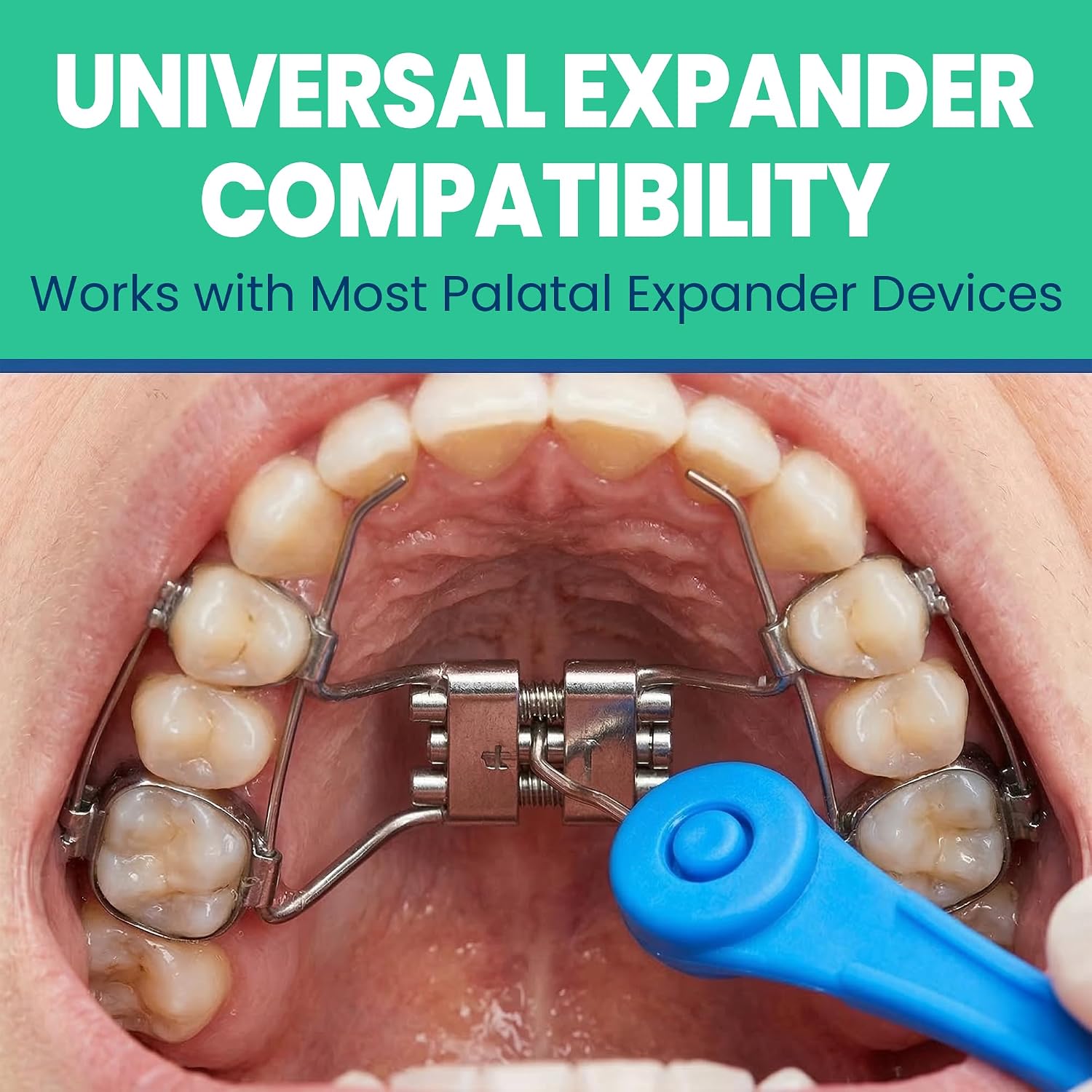 Expander Key, Palate Expander Tool for Palatal Expanders 2 Pack image 5