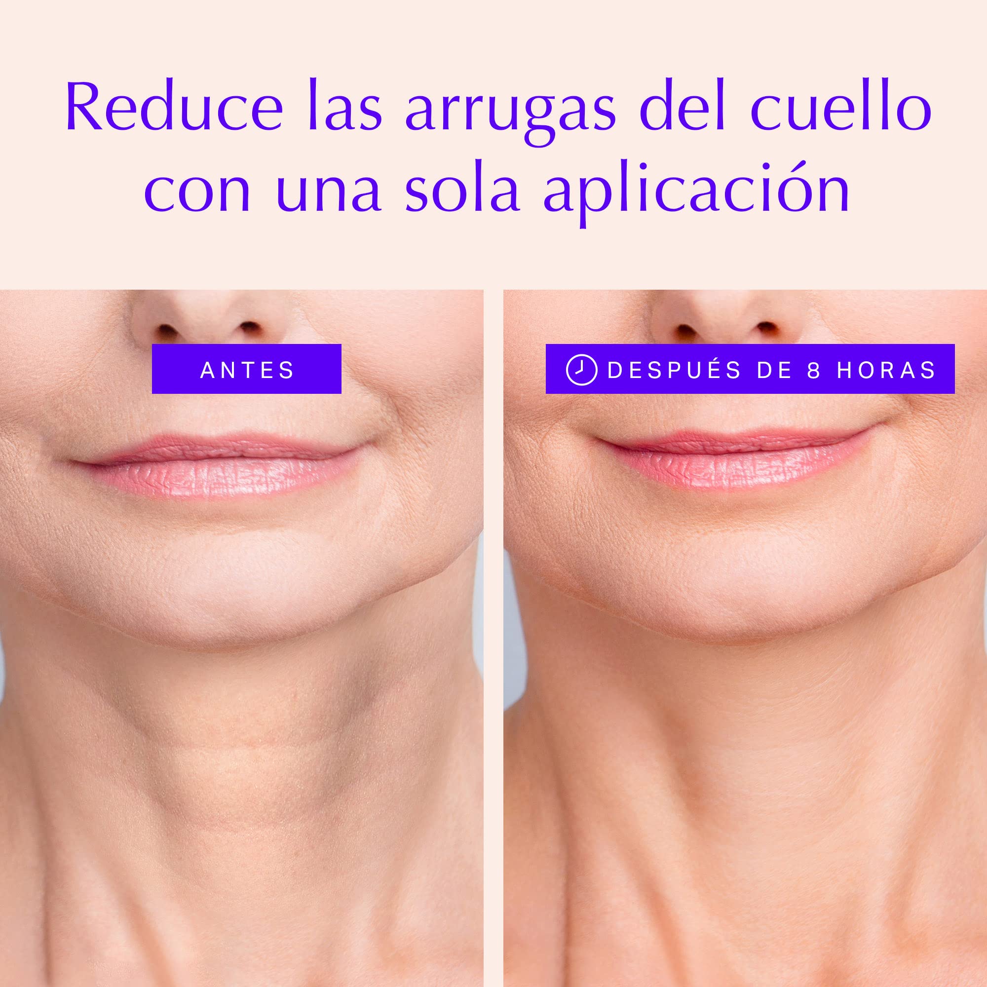 Almohadillas Antiarrugas para Cuello - Silicona Reutilizable para Arrugas del Escote - Prevenir y Eliminar Arrugas de Piel - Reafirmante, Tonificante, Más Natural Alternativa al Botox (Para 1 mes)