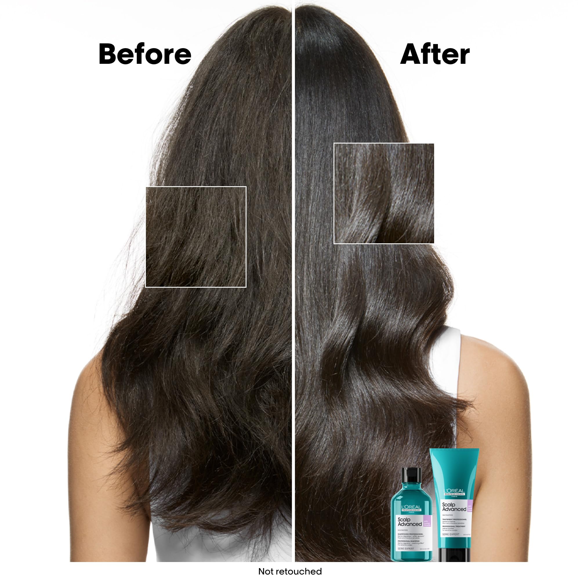 L’Oréal Professionnel Scalp Advanced Anti-Discomfort Shampoo, for Itchy and Dry Scalps Deep Scalp Treatment, 500ml - Image 3