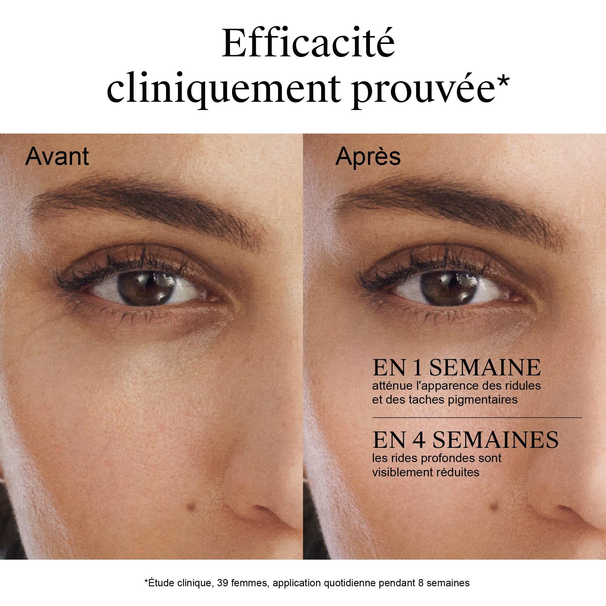 Neutrogena – Crème de Nuit Anti-Âge Intense Retinol Boost+ (pot de 50 ml) – Soin visage au rétinol pour combattre les signes visibles du vieillissement – Anti-rides à l’effet repulpant