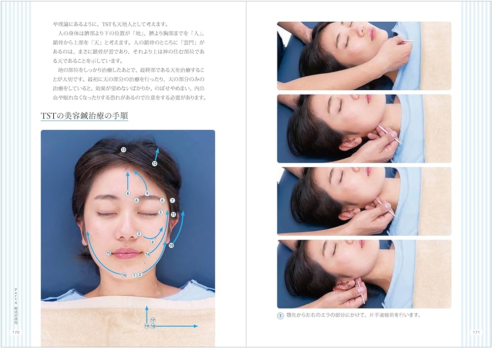 てい鍼テクニック   /医道の日本社/船水隆広（単行本） Amazon.co.jp: てい鍼テクニックー船水隆広のTST- : 船水 隆広: 本