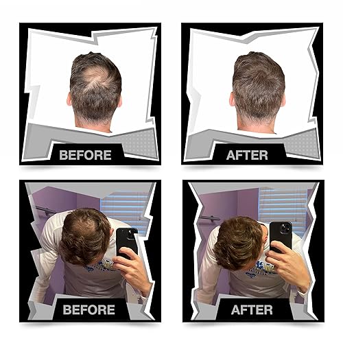 Miniatura 2 de Fibras de construcción del cabello para adelgazar el cabello para hombres  Rellenos de cabello en polvo  Espesante de cabello para adelgazamiento