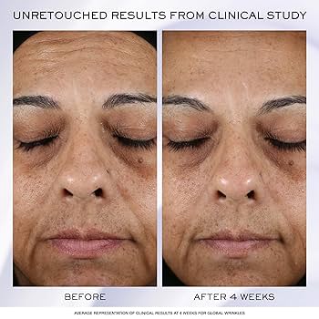 Collana premium rich cream New ⑧ Black Diamond Retinol Oil – Cos Bar