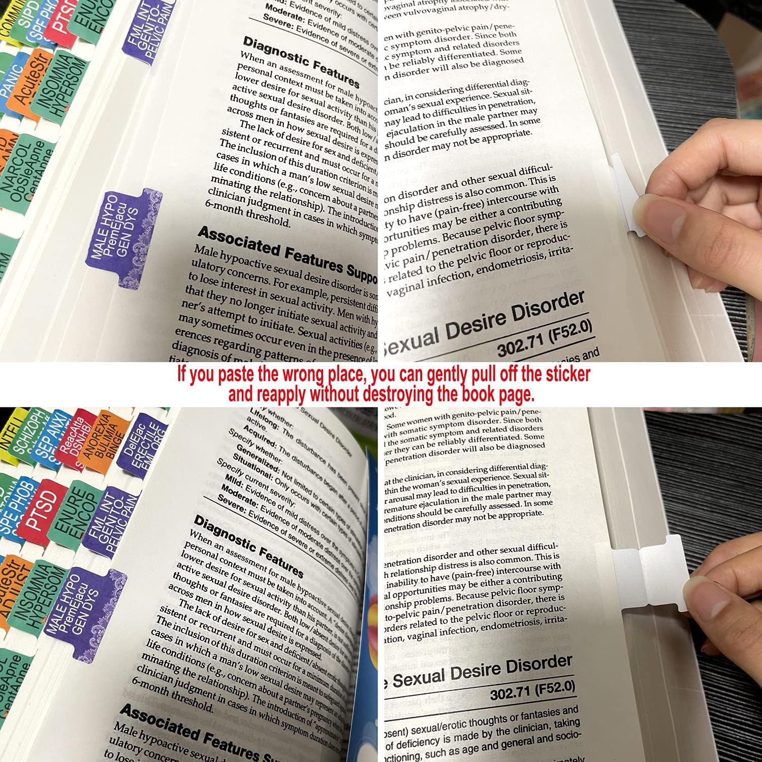 Colorful Index Tabs for D.S.M 5th Edition, 84 Index tabs in Total, 72 Diagnosis Guide tabs with Page Markers and Additional 12 Blank tabs : Office Products