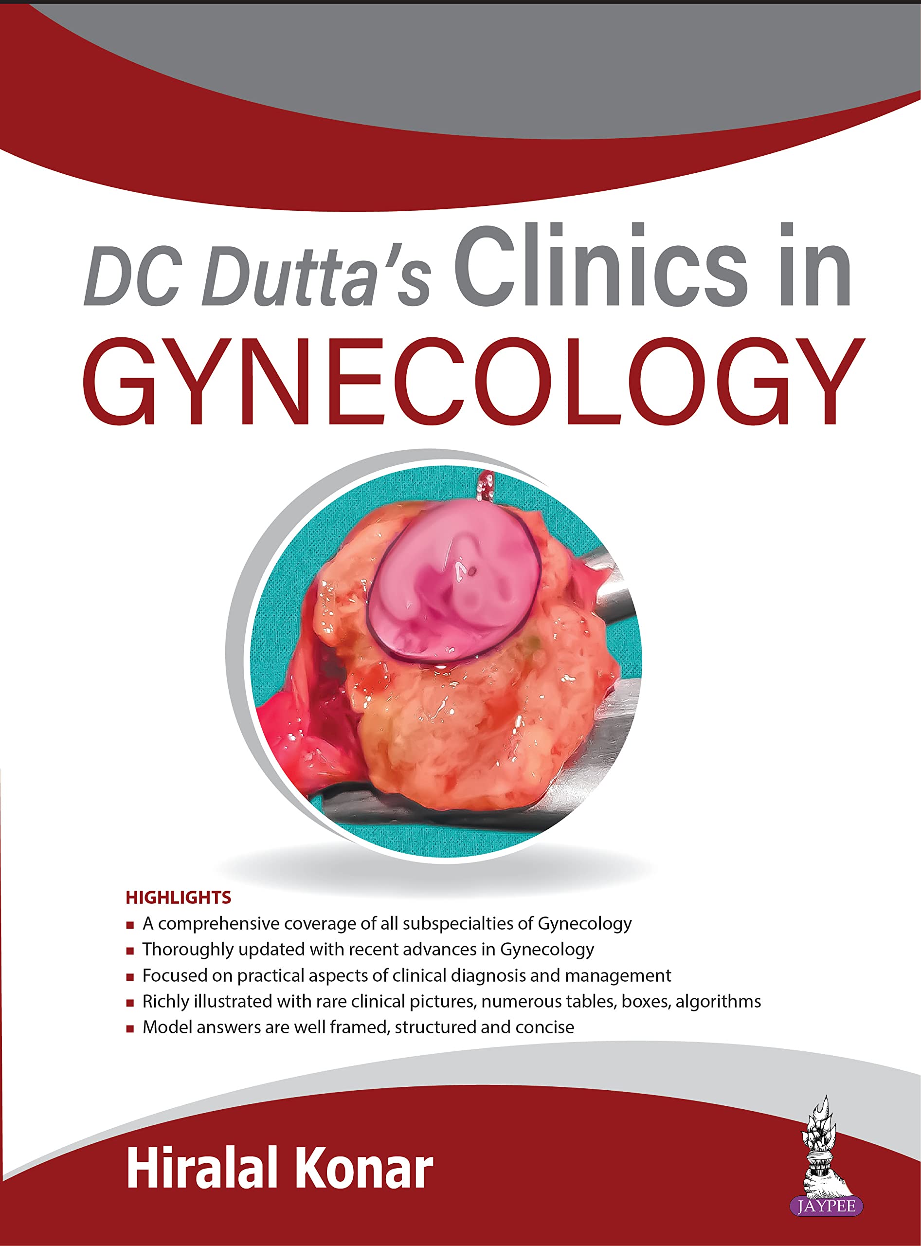 DC Dutta’s Clinics in Gynecology