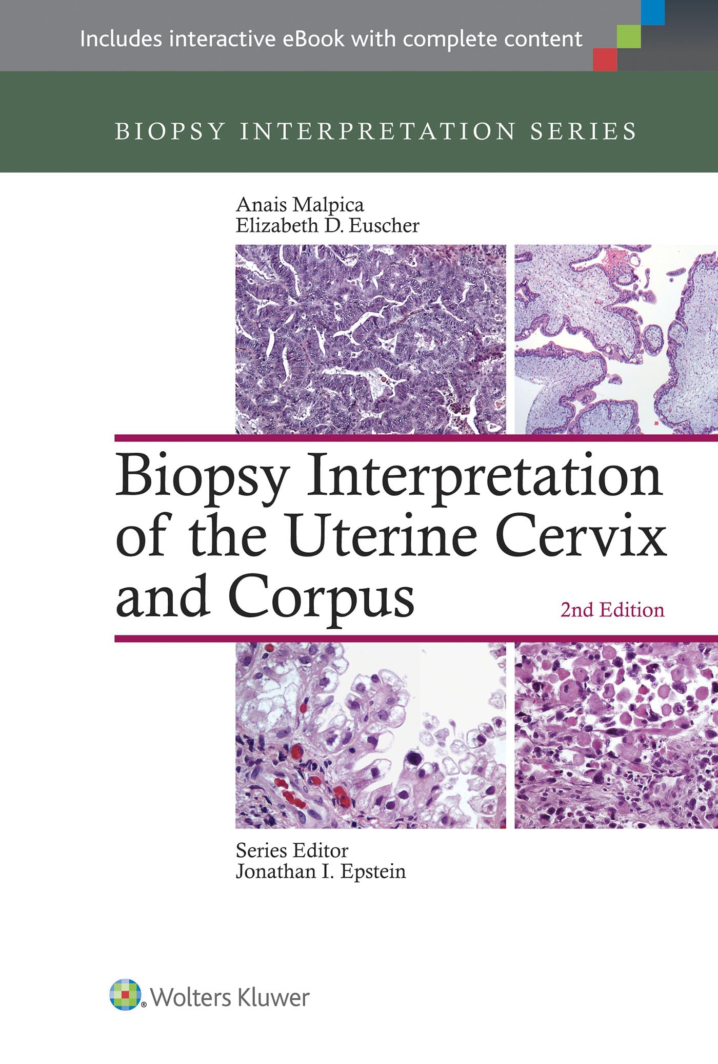 Lippincott Williams And Wilkins Biopsy Interpretation Of The Uterine Cervix And Corpus