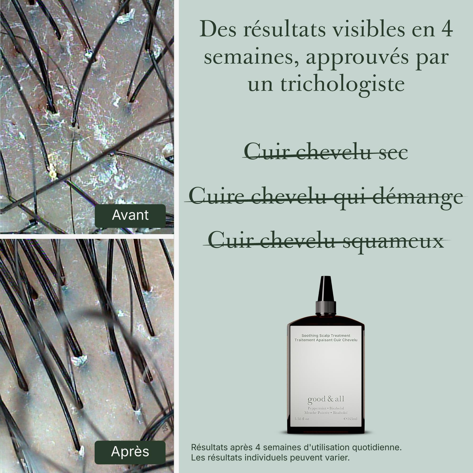 Good&All Traitement Anti-Démangeaisons Pour Cuir Chevelu Irrité, Sec & Sensibles - Sans Rinçage, Parfum - avec Menthe Poivrée & Bisabolol - 165ml