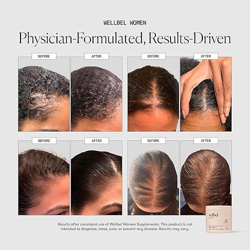 Miniatura 4 de WELLBEL Suplemento limpio para cabello, piel y uñas, vegano, sin gluten y sin OMG, 90 unidades (paquete de 3)