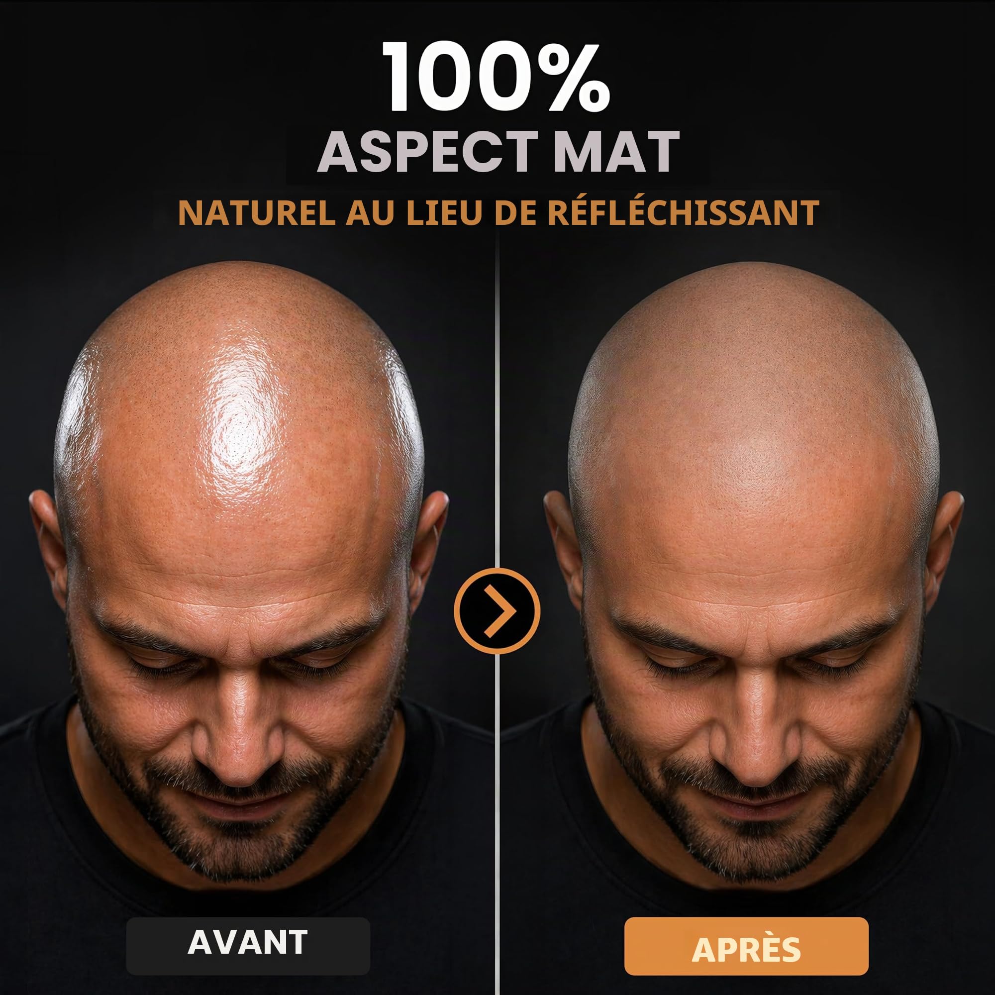 2.0 | Soin matifiant anti-brillance | Crème nourrissante contre la calvitie | Hydratant cuir chevelu | Idéal pour la pigmentation SMP (74 g)