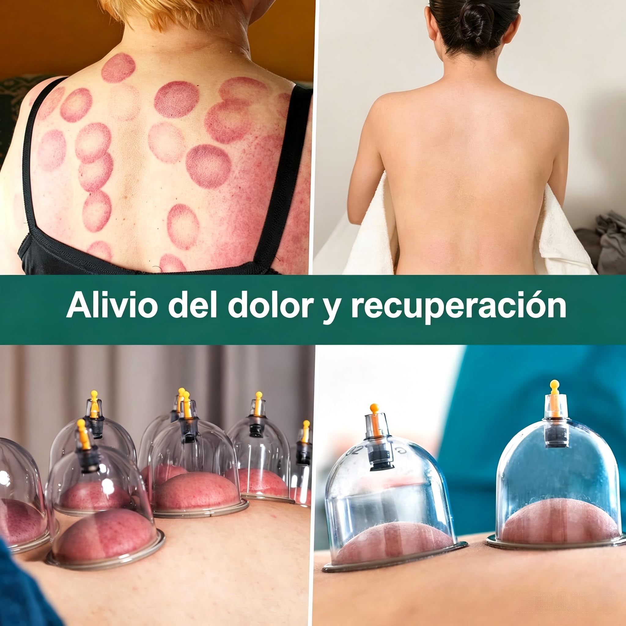 Juego de 20 ventosas para terapia de ventosas, tamaño grande V2.0, para hombres y mujeres, vasos de vacío para músculos corporales, dolor de espalda, masaje, celulitis, ventosa, juego de