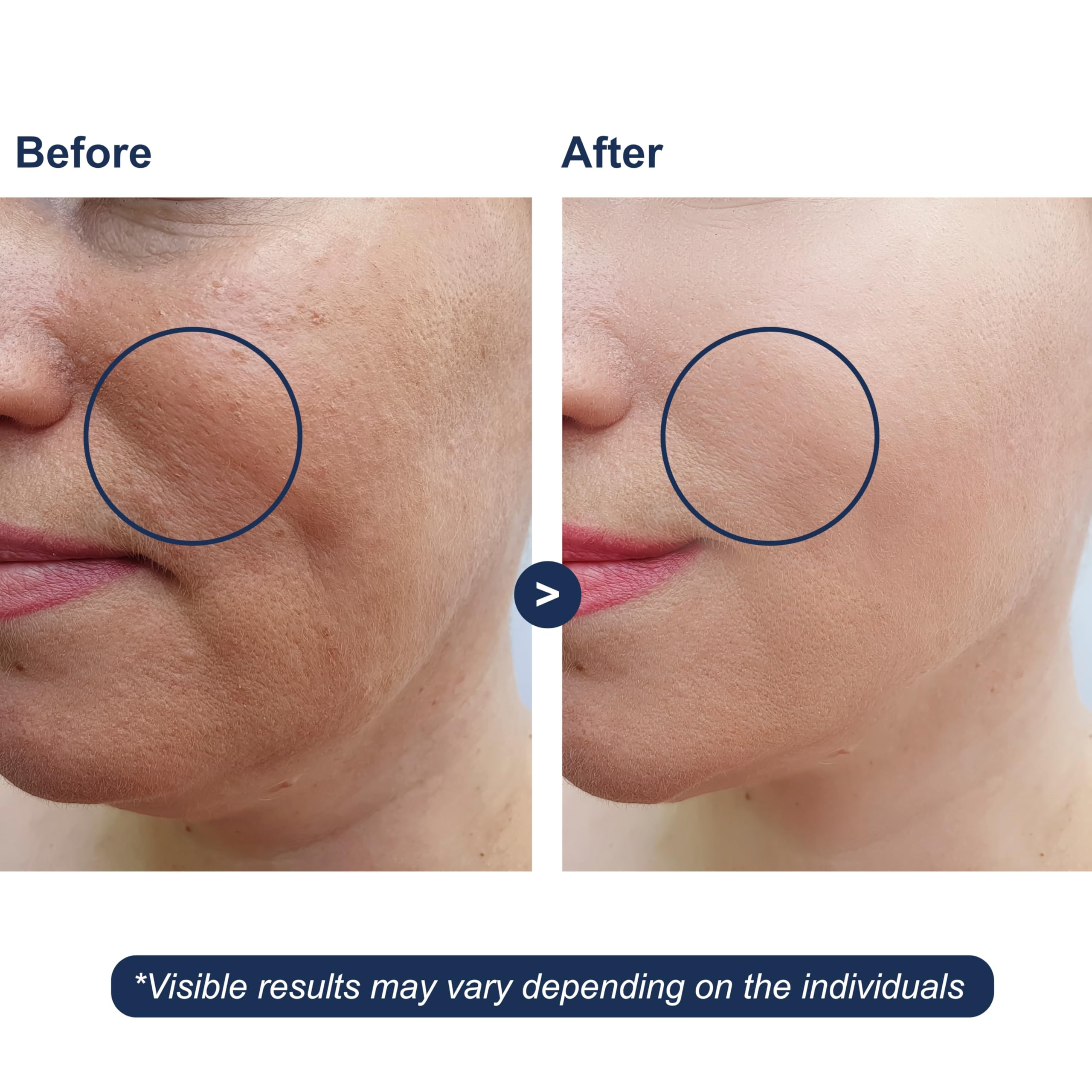 Amazon.com : Hyaluronic Acid Serum with Vitamin B5 for Face