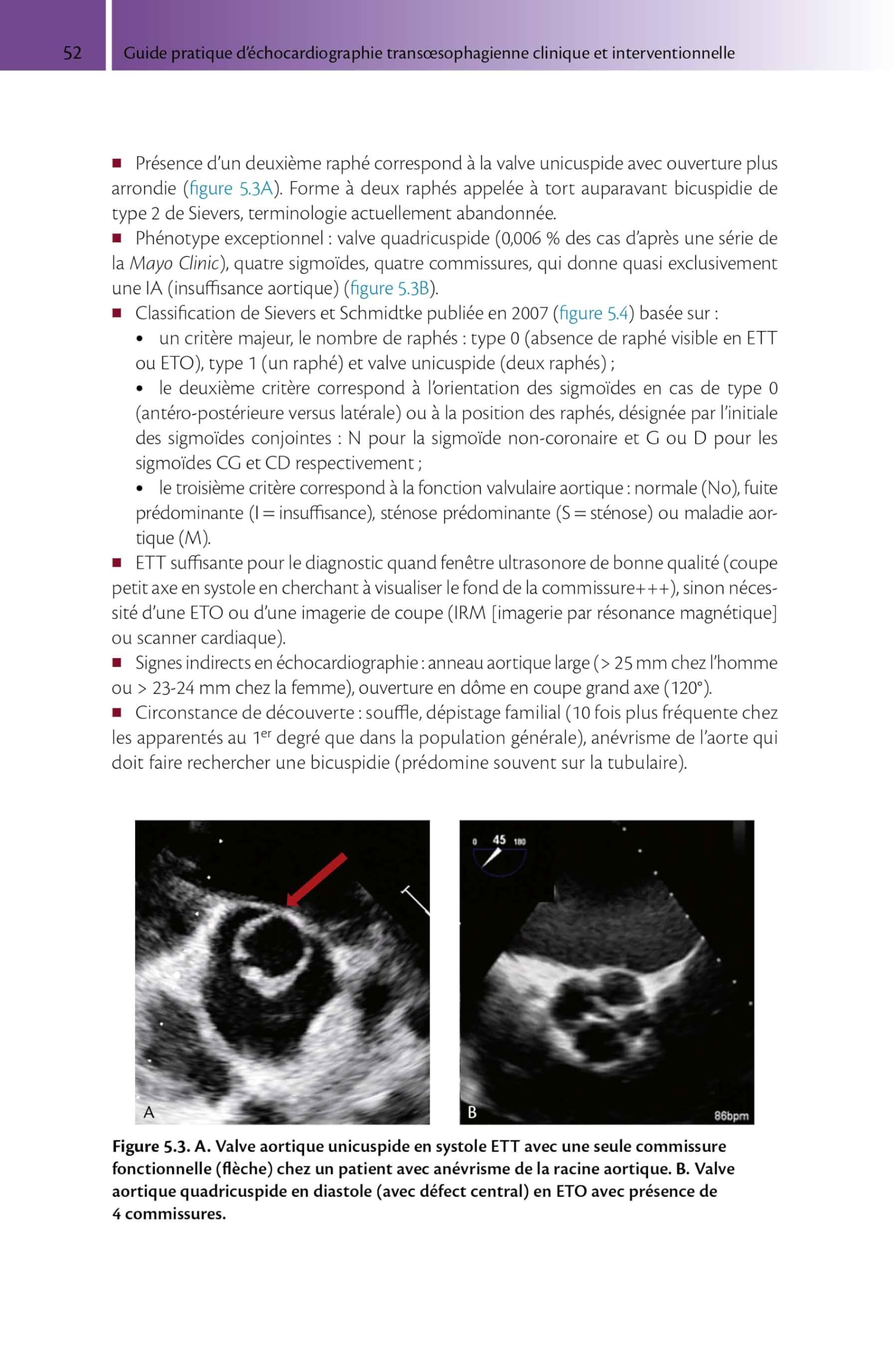 Guide pratique d'échocardiographie transoesophagienne: clinique et interventionnelle