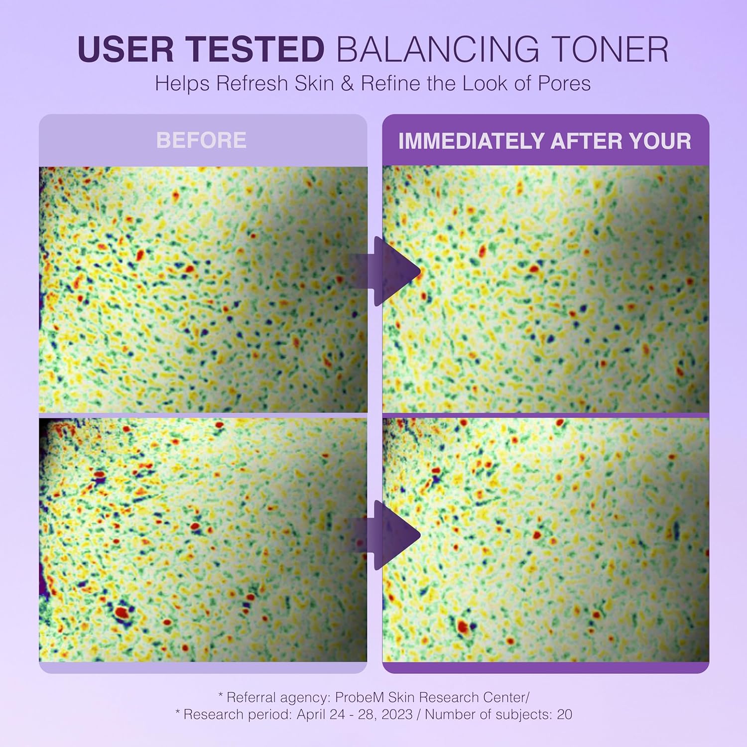 Be-Hope Vegan Luxury Smoothing Toner – Hydrating and Calming Facial Toner with Vegan Peptides, Panthenol, Allantoin – pH Balanced, Sensitive Skin – 200ml / 6.76 fl oz - Image 2