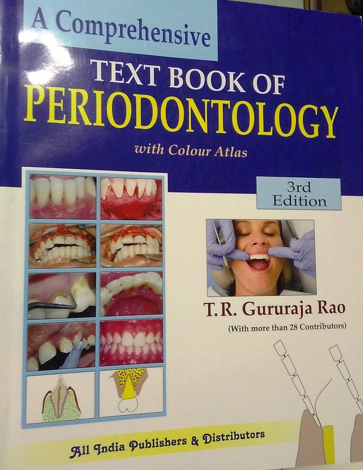 健康・医学 Textbook of Clinical Periodontology Newman and Carranza's Clinical Periodontology an: 14th