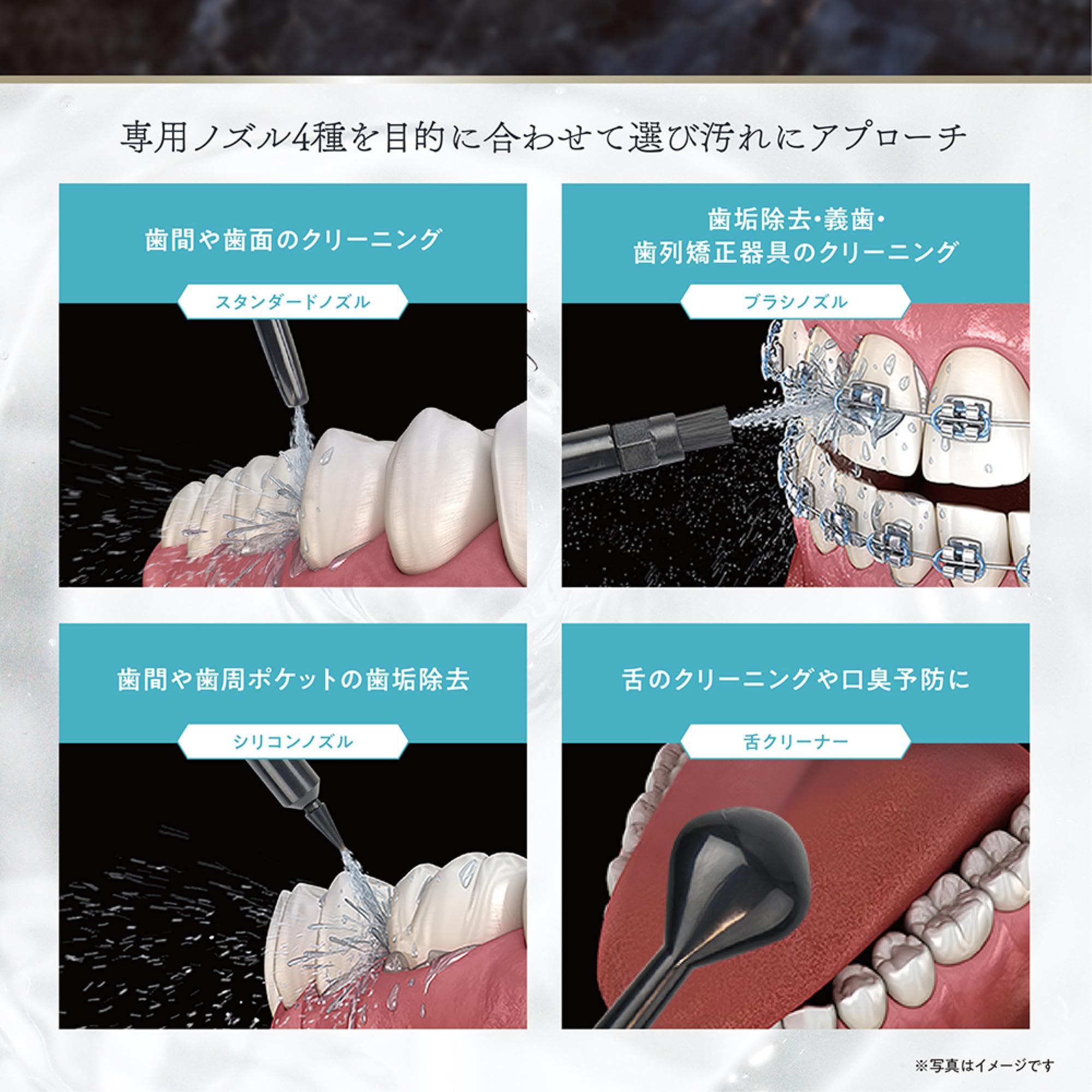 Amazon.co.jp : エステエール マウスウォッシャー 口腔洗浄器 水圧