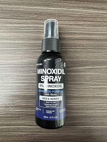 Spray de minoxidil al 5 % para hombres y mujeres, minoxidil para el cabello de hombres, spray para el crecimiento del cabello, evita el