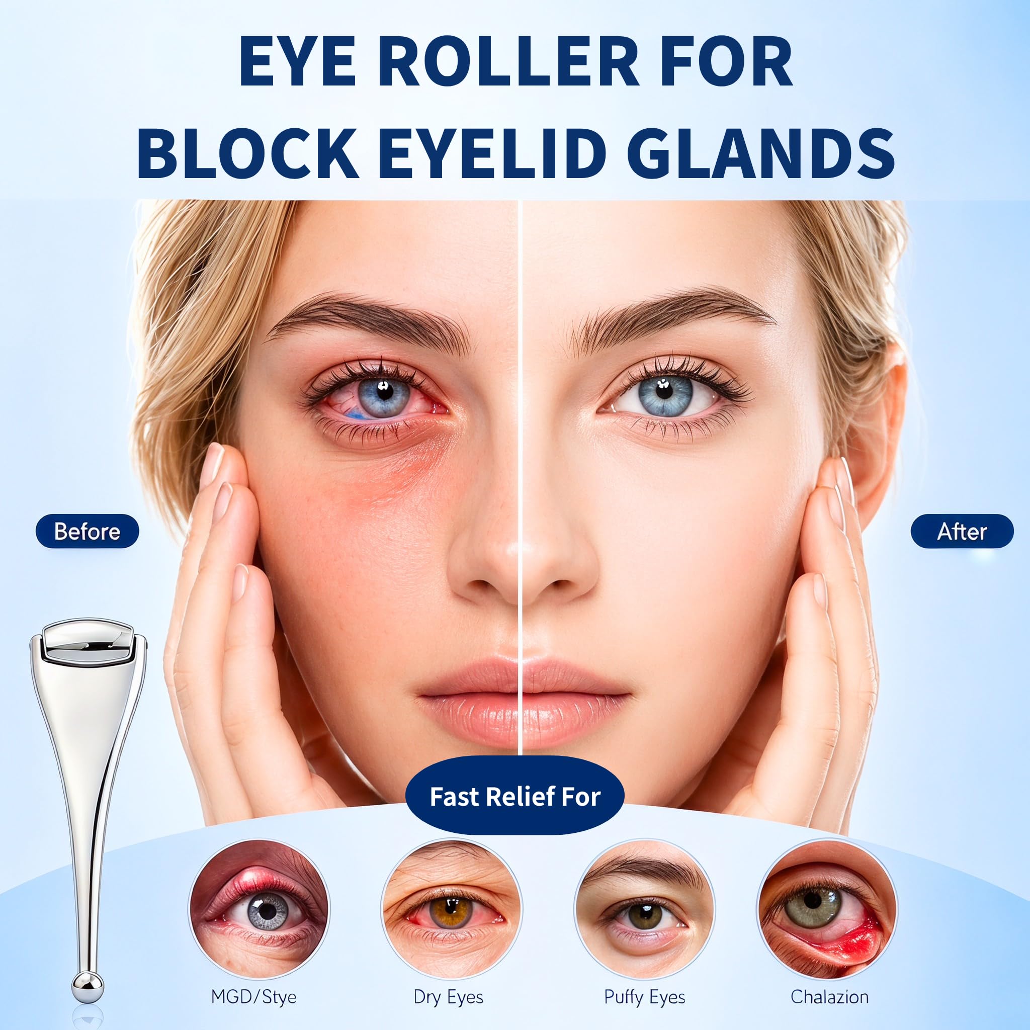 Metal Eye Roller for Dry Eye Relief & Puffy Eyes- Eyelid Roller for Chalazion,Stye,MGD Relief,Improves Meibum Flow and Unclogs Oil Glands,Gentle Meibomian Gland Expression for Blocked Eyelid Glands — Amazon image 2