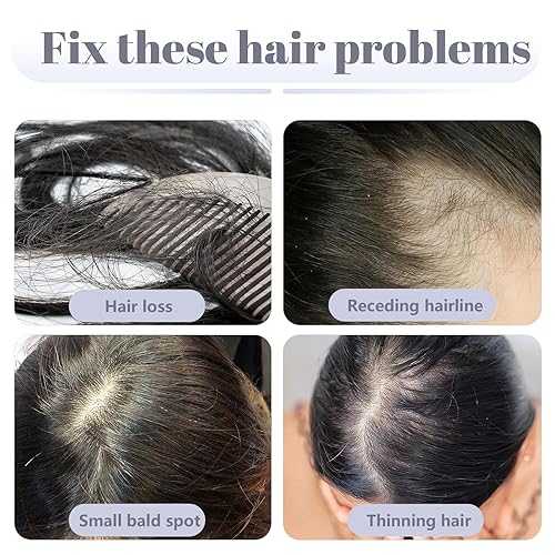 Miniatura 7 de SEGO Toppers de cabello humano de 10 pulgadas, 0.99 oz, parte media con clip para mujer, base de encaje de seda hecha a mano para pérdida de cabello