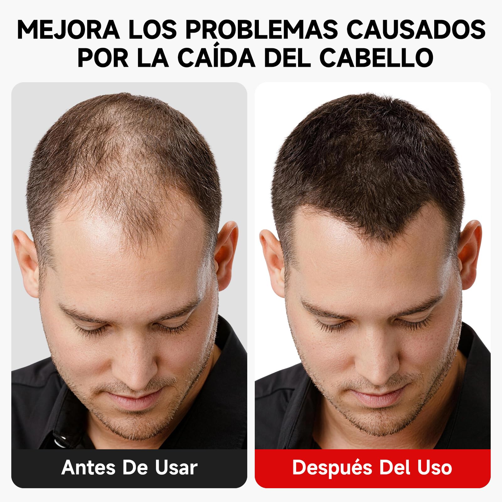 Gorra para Crecimiento del Cabello 660 nm 850 nm 7 Modos Dispositivo Láser